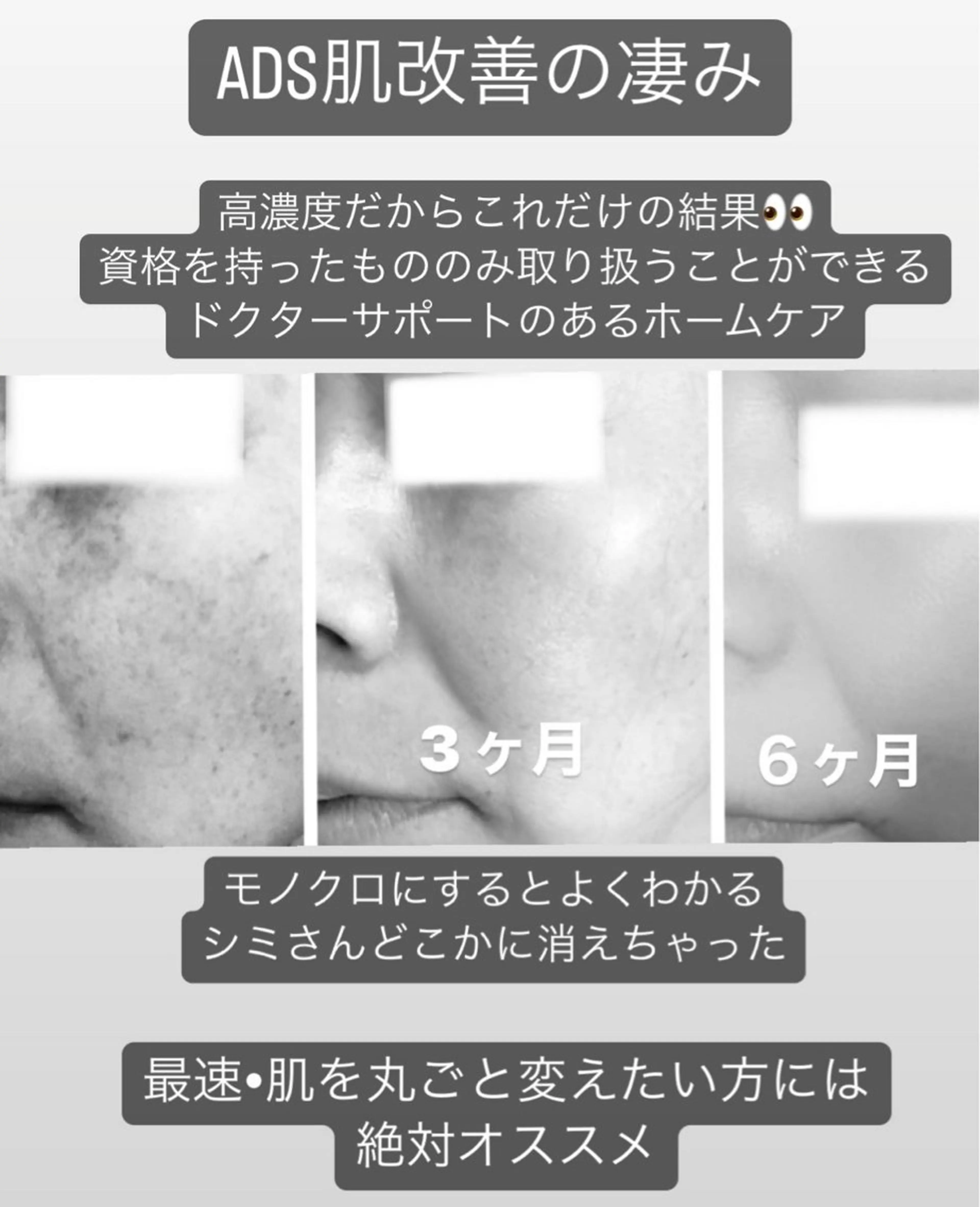 private salon  Dea_maris シュガーリング＆パーソナルボディケア所属・シミ改善・韓国肌管理 ボディメイク痩身のその他イメージ