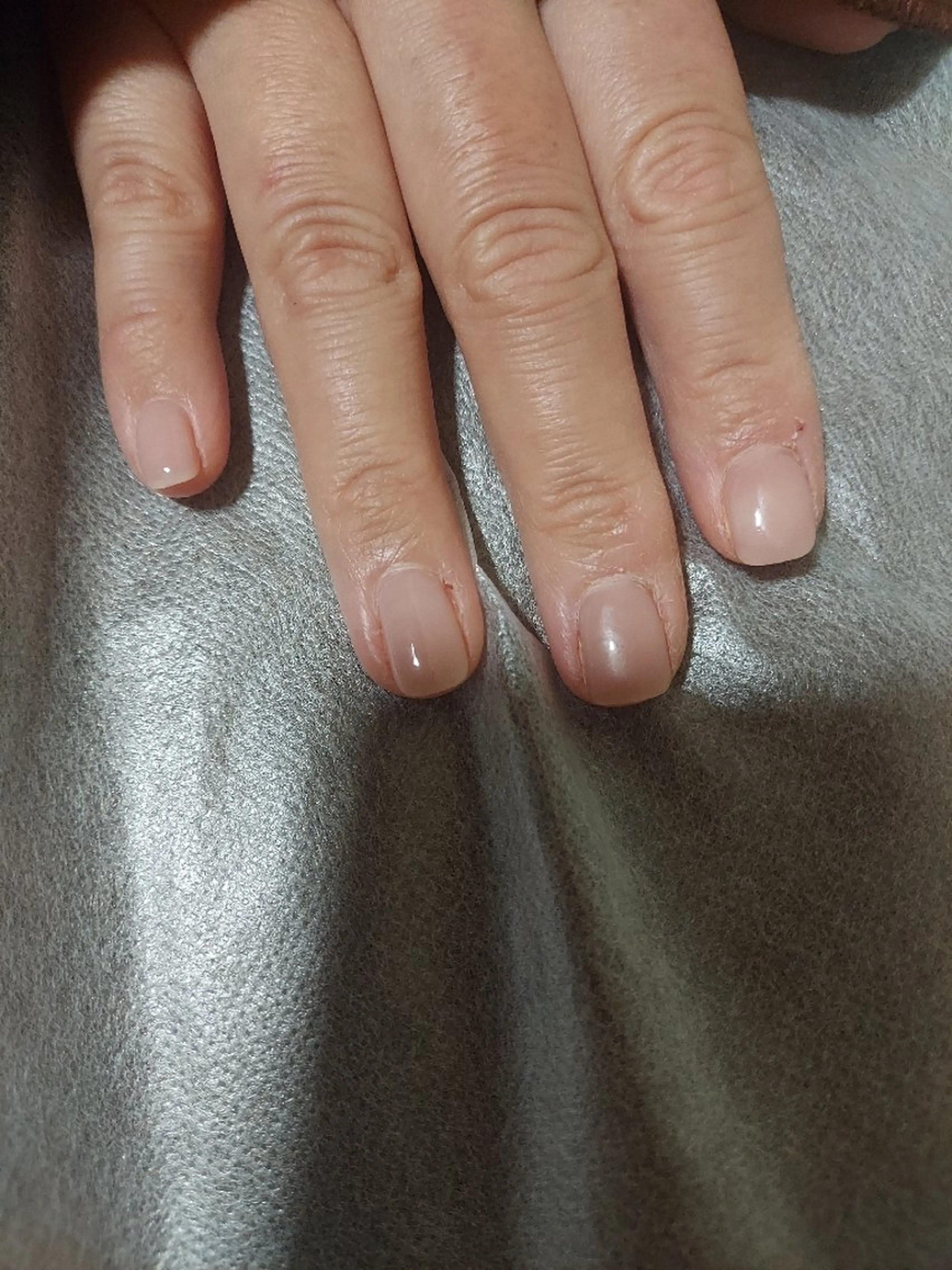 脱毛 macheriena りなのエステ・リラクイメージ