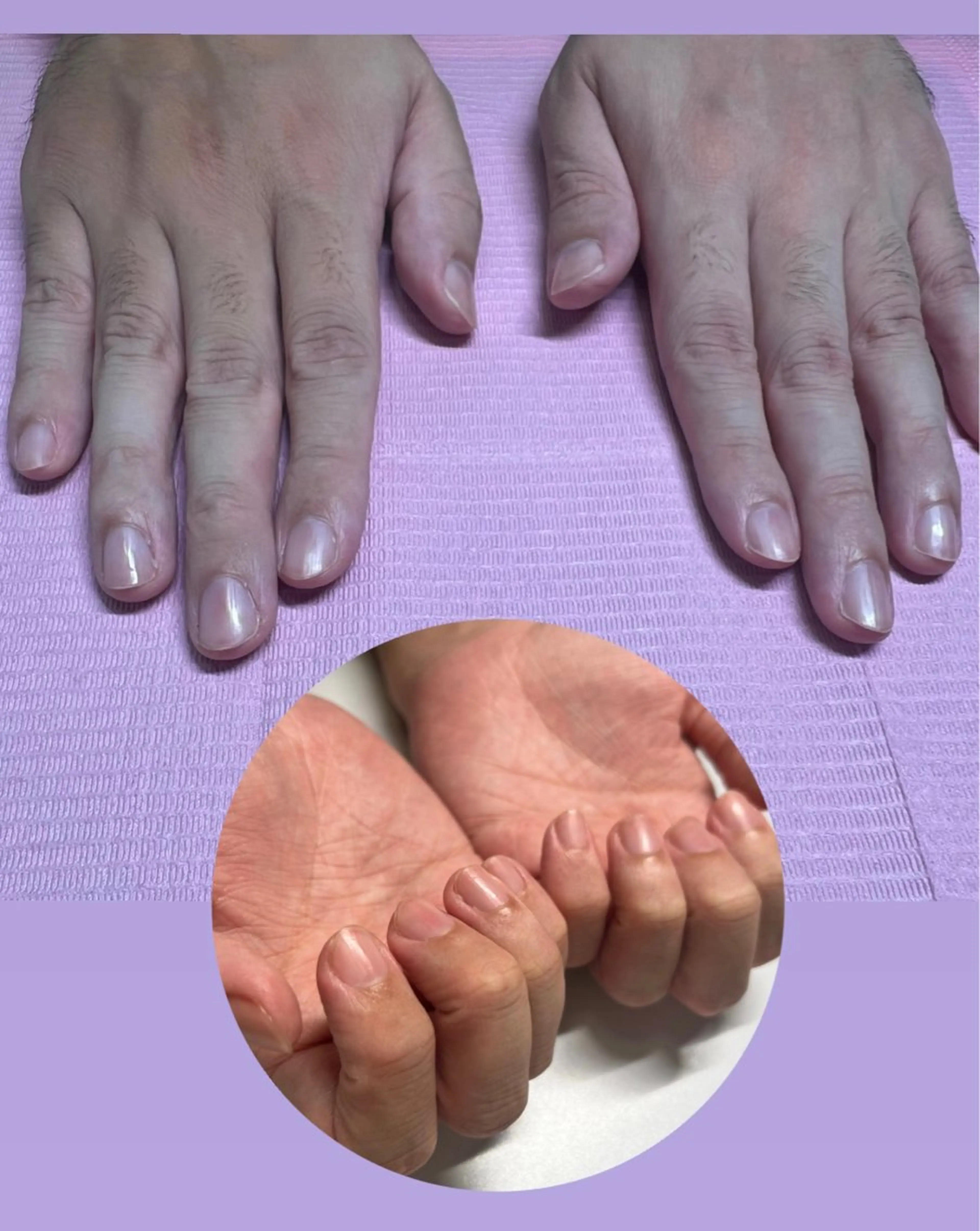 メンズ ネイル 爪ケア/深爪 自爪育成 🐰えむのネイルデザイン