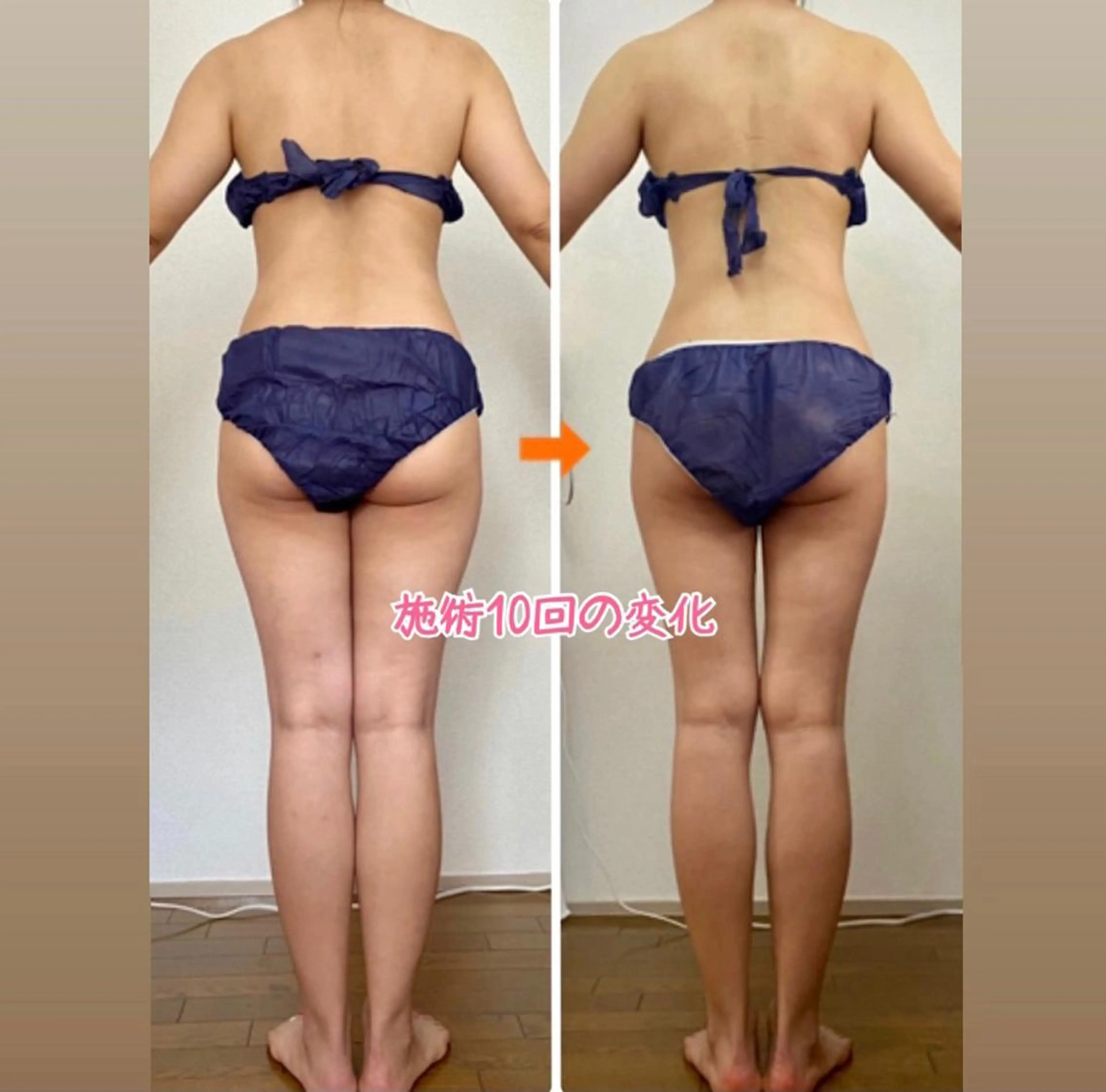 ショート カラー パーマ ヘアアレンジ メンズ キッズ ネイル マツエク・マツパ エステ リラク ‍痩身＆ボディ 結果出し🌟丹野のエステ・リラクイメージ