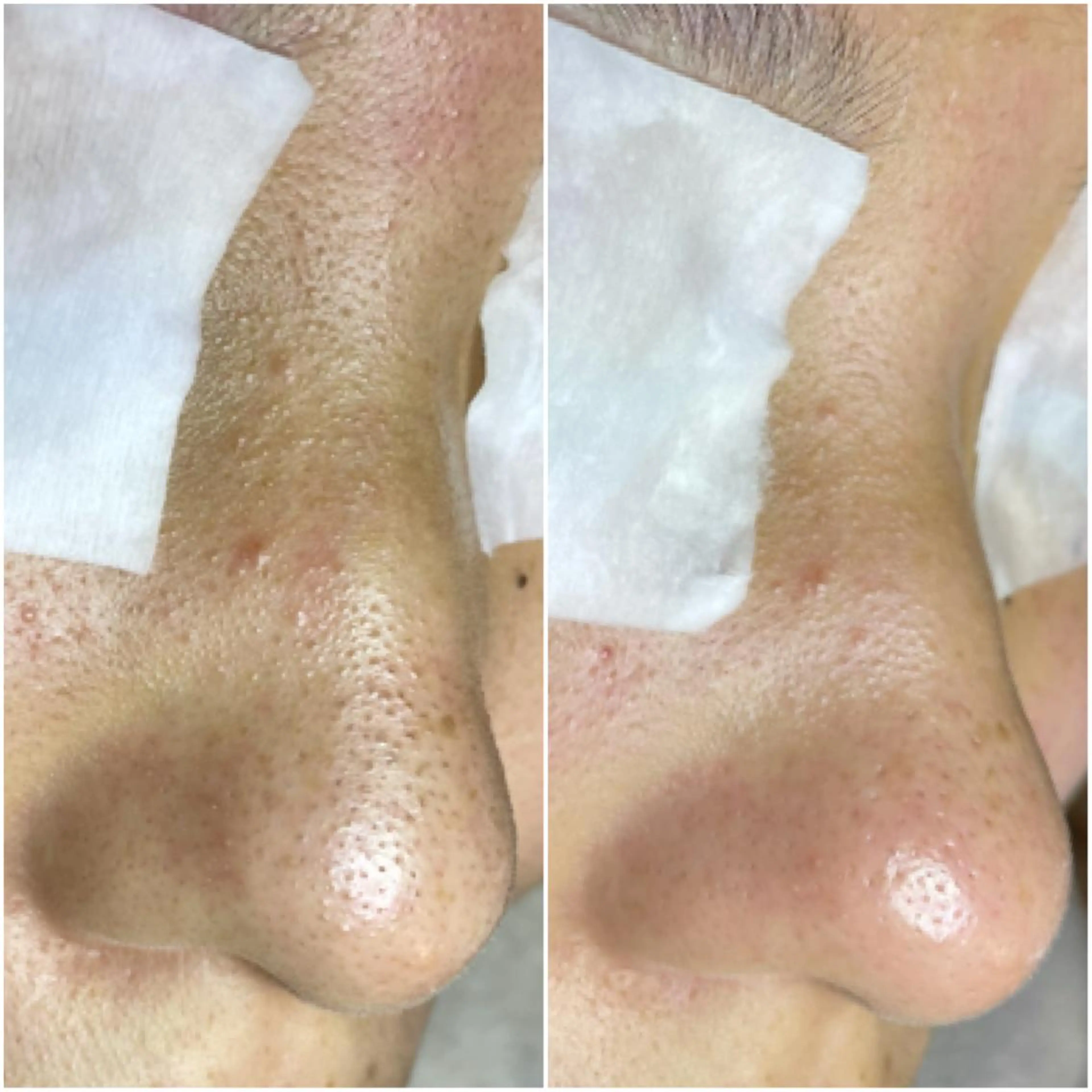 毛穴肌育専門店 リールのエステ・リラクイメージ