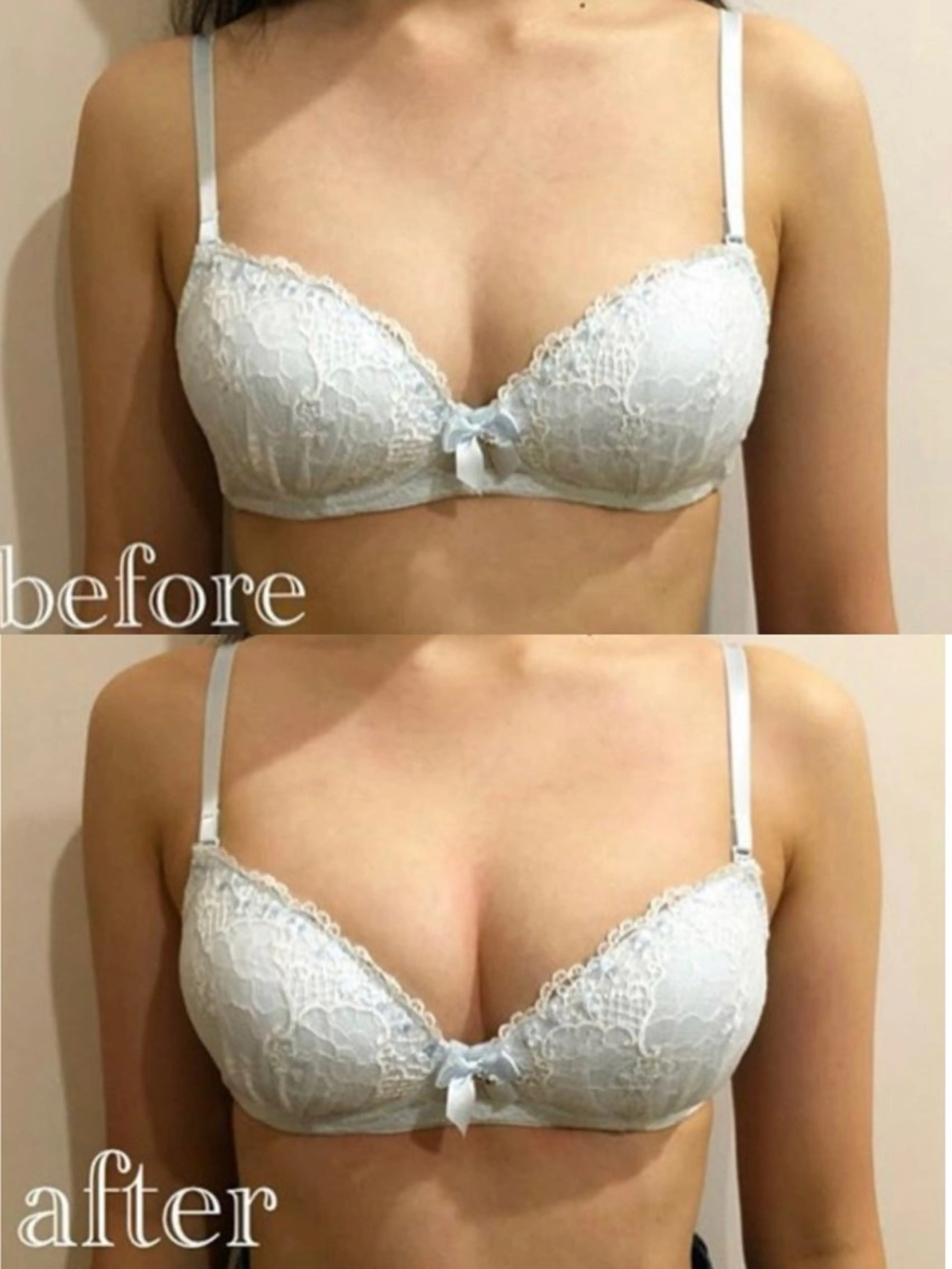 Mellow所属・ブライダル専門バスト サロンMellowのエステ・リラクイメージ