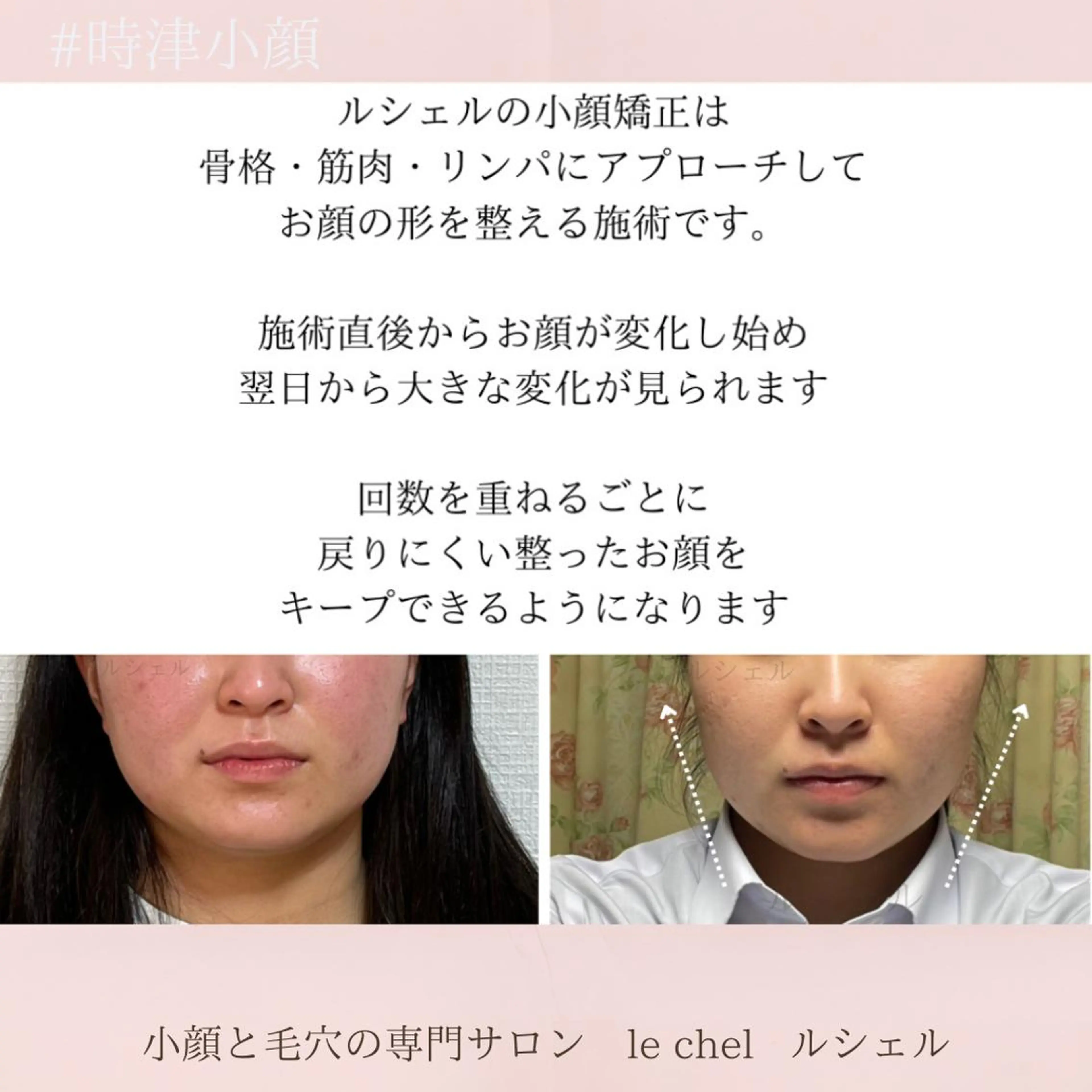 小顔・毛穴専門サロン　le chel 　ルシェル所属・小顔・毛穴専門 ルシェルのエステ・リラクイメージ