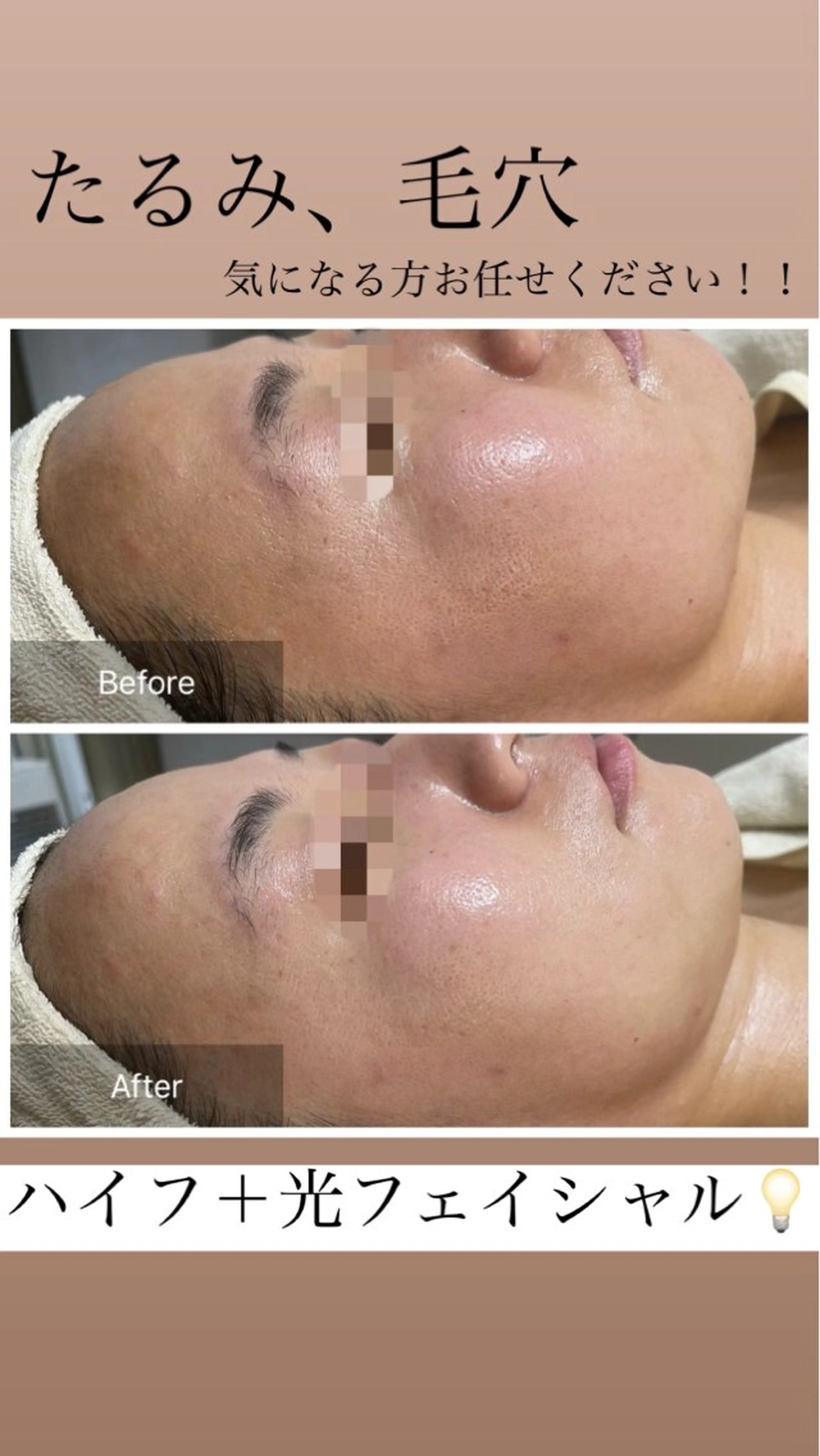 Private  Beauty Salon " MEILI"所属・meili salonのエステ・リラクイメージ