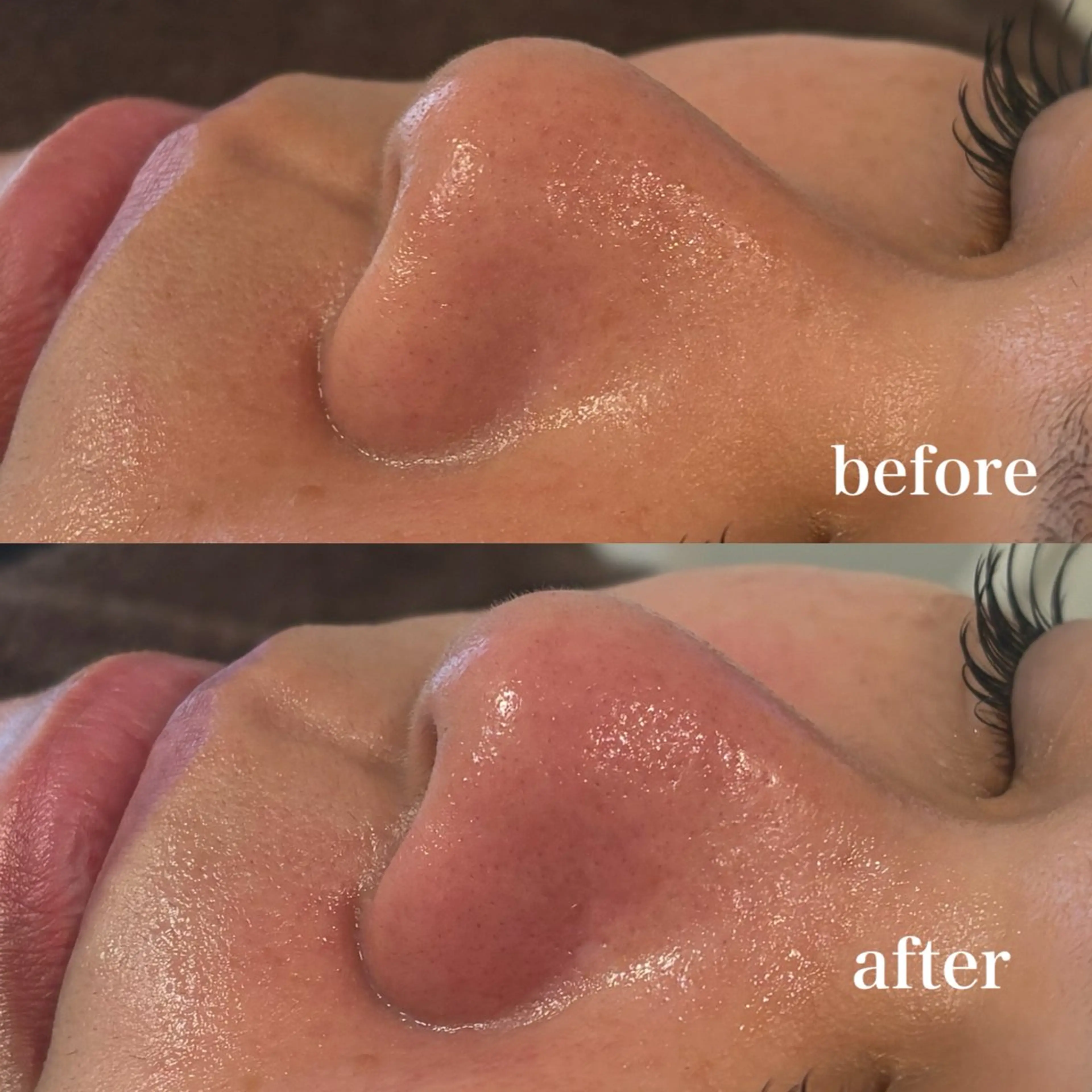 エステ 美養HAREHADA 🫧/ Ibukiの眉毛・アイブロウイメージ