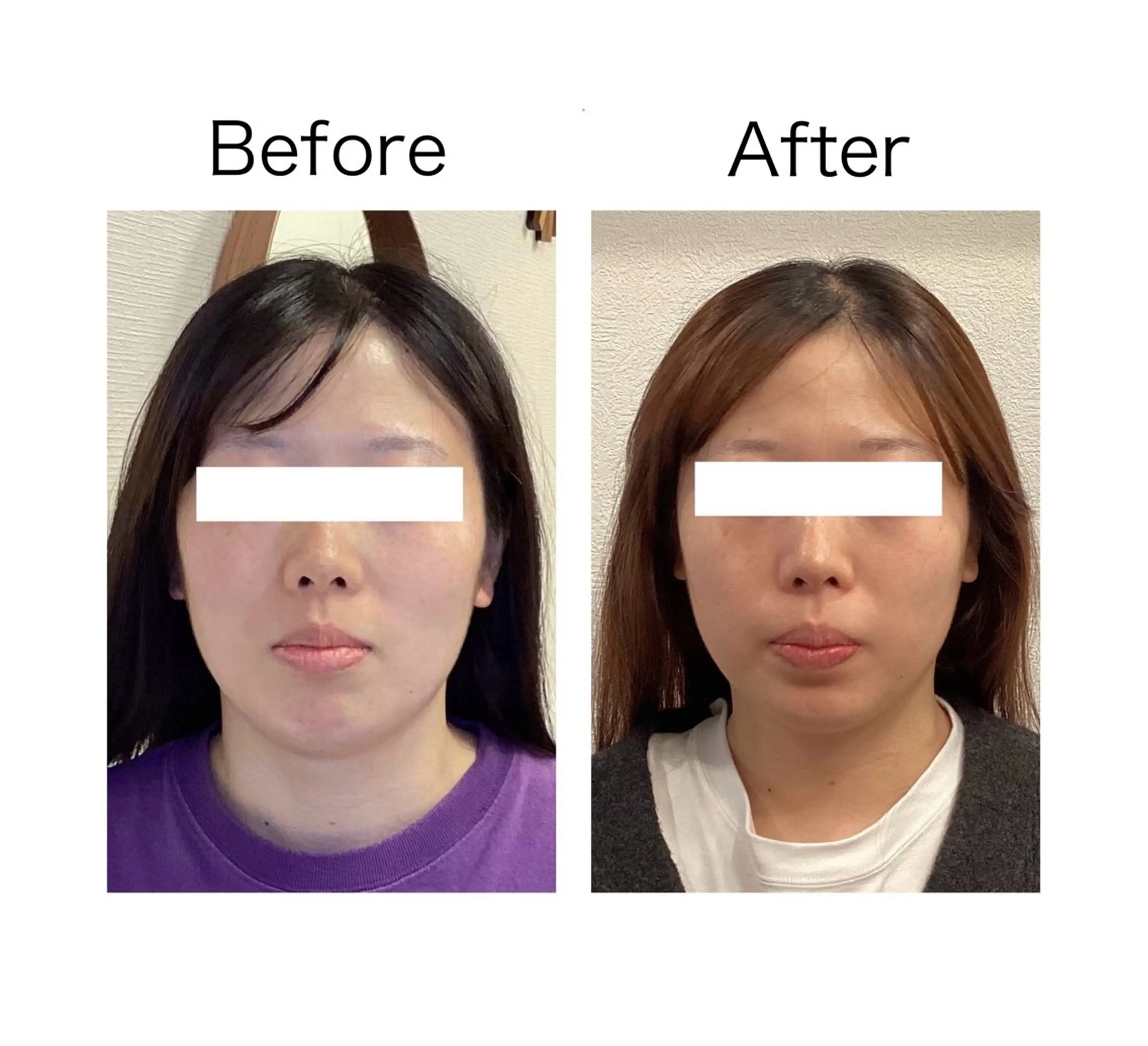 小顔サロンSharp …腸調整よもぎ蒸しのエステ・リラクイメージ