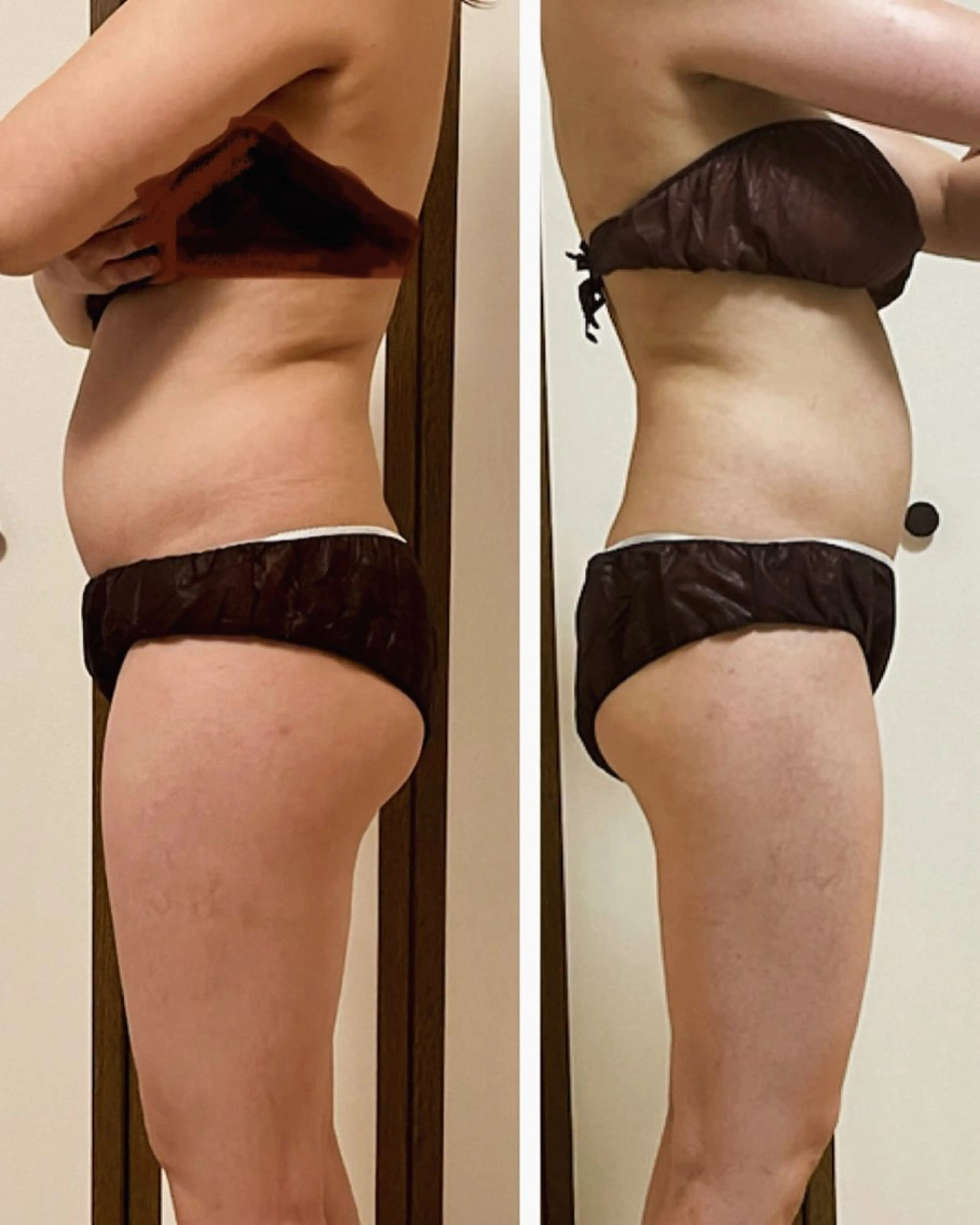 【浮腫み凝りスッキリ筋膜の流れに沿ってじっくりマッサージ】detoxリンパ90分（ドライヘッド、デコルテ、発汗付き）の写真