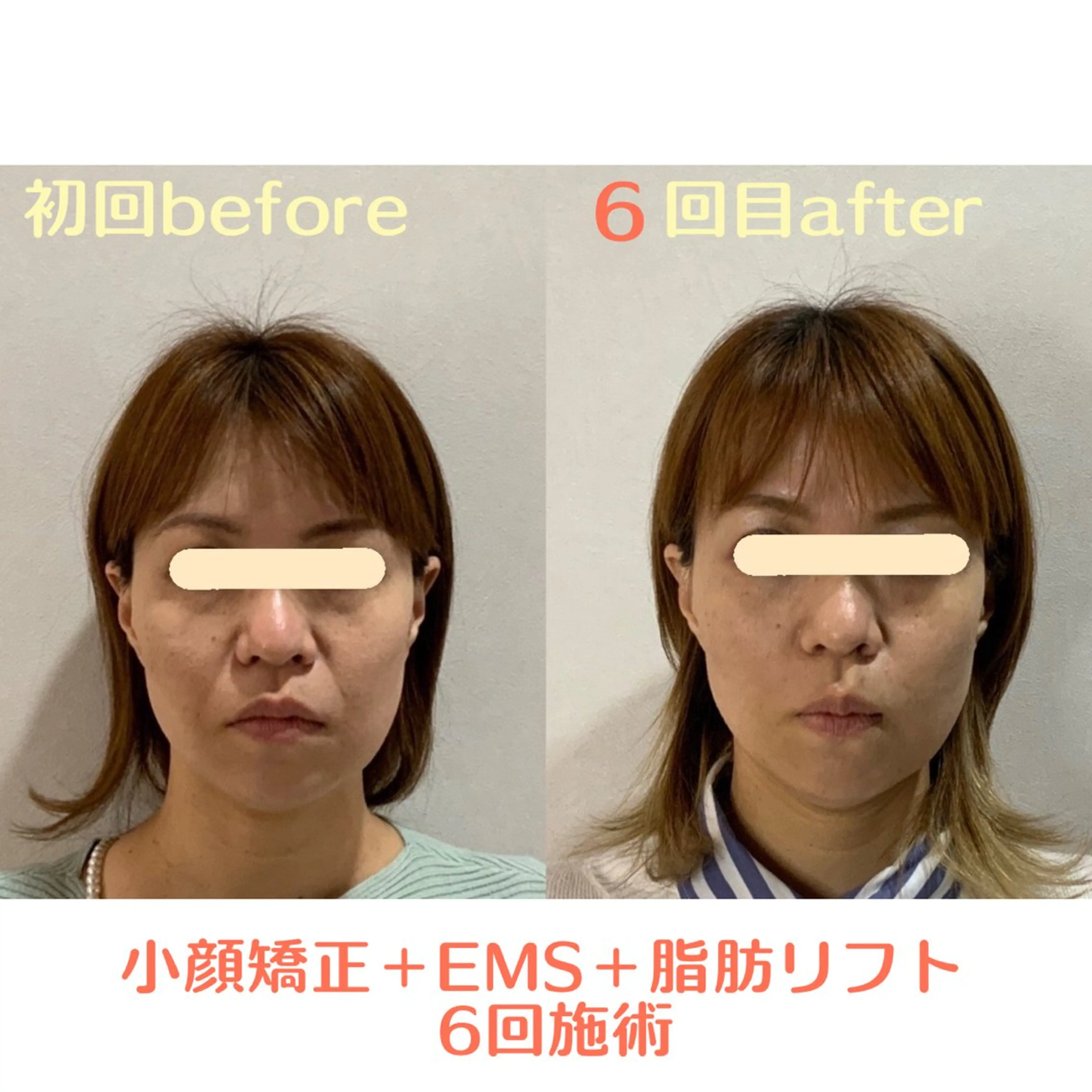 エステ 最速小顔・肌質管理 ❣️エスポワールのエステ・リラクイメージ