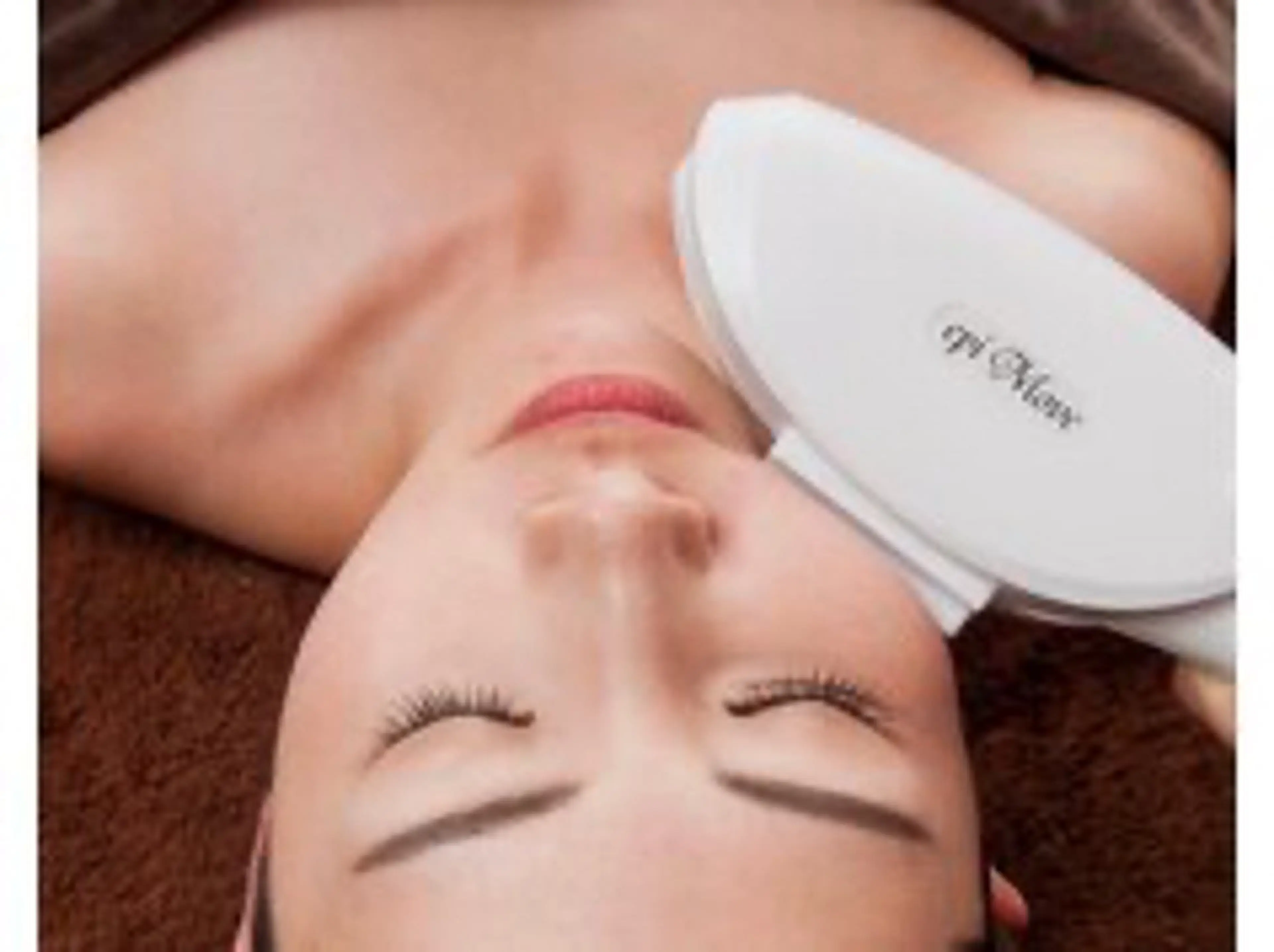 『💫1番人気💫』光フェイシャル(IPL照射)の写真