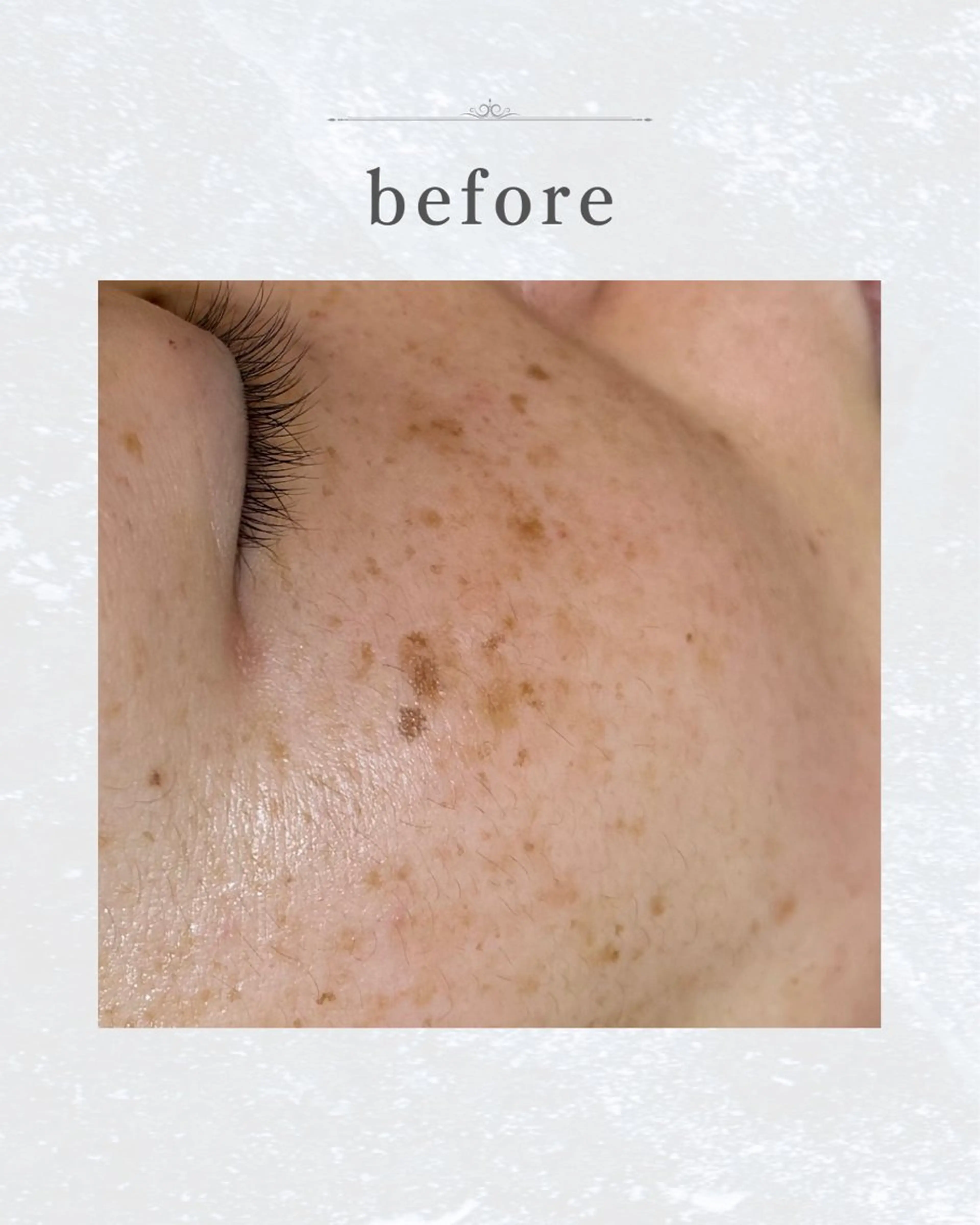 なにわのシミ取り職人 YUKIのエステ・リラクイメージ