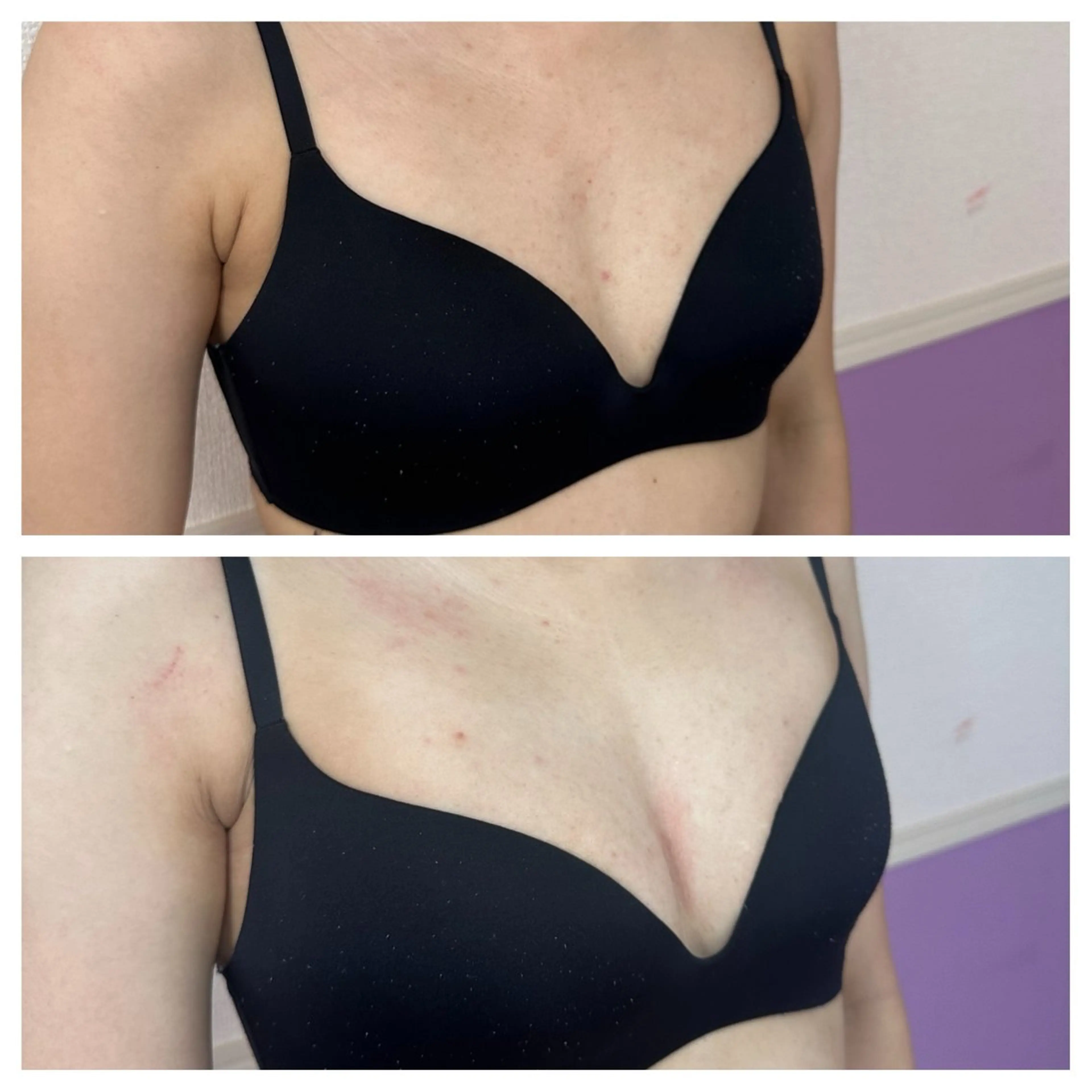 Miel所属・バストアップサロン Mielのエステ・リラクイメージ