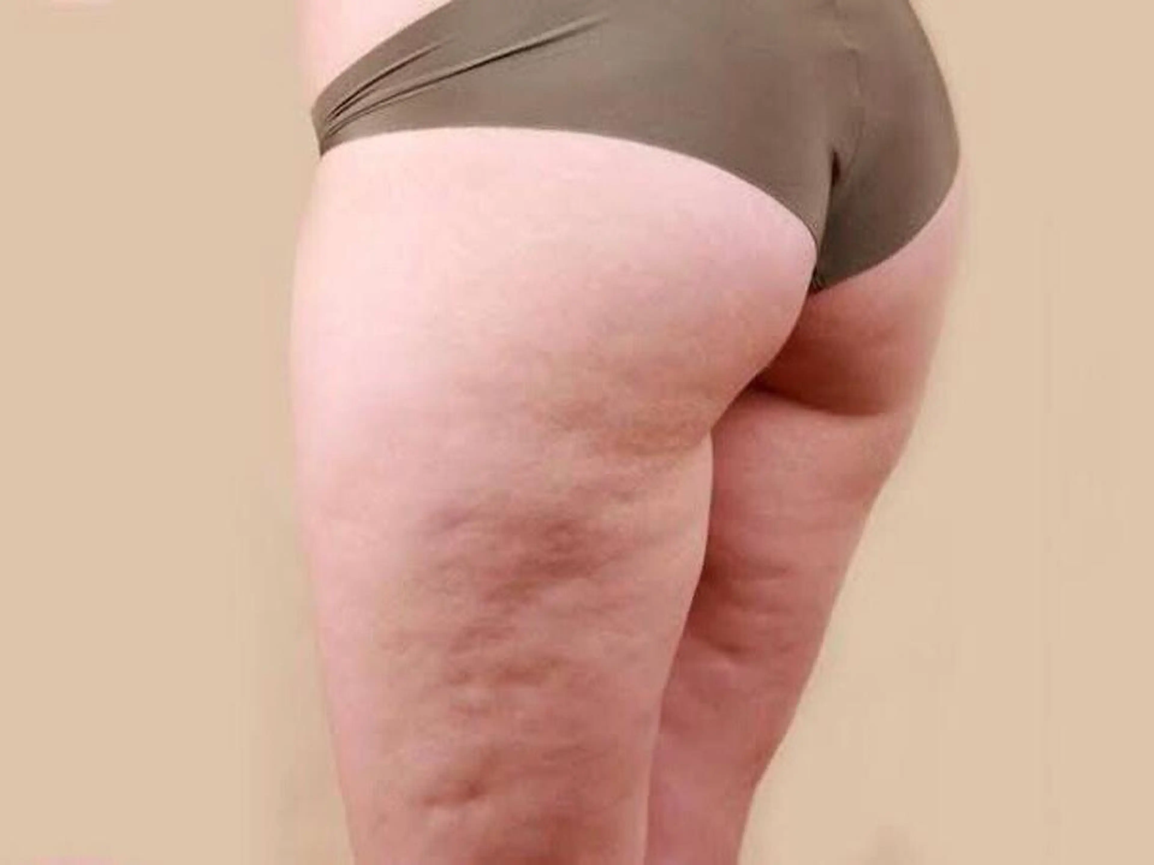 その他 YOSA PARK TLYのエステ・リラクイメージ