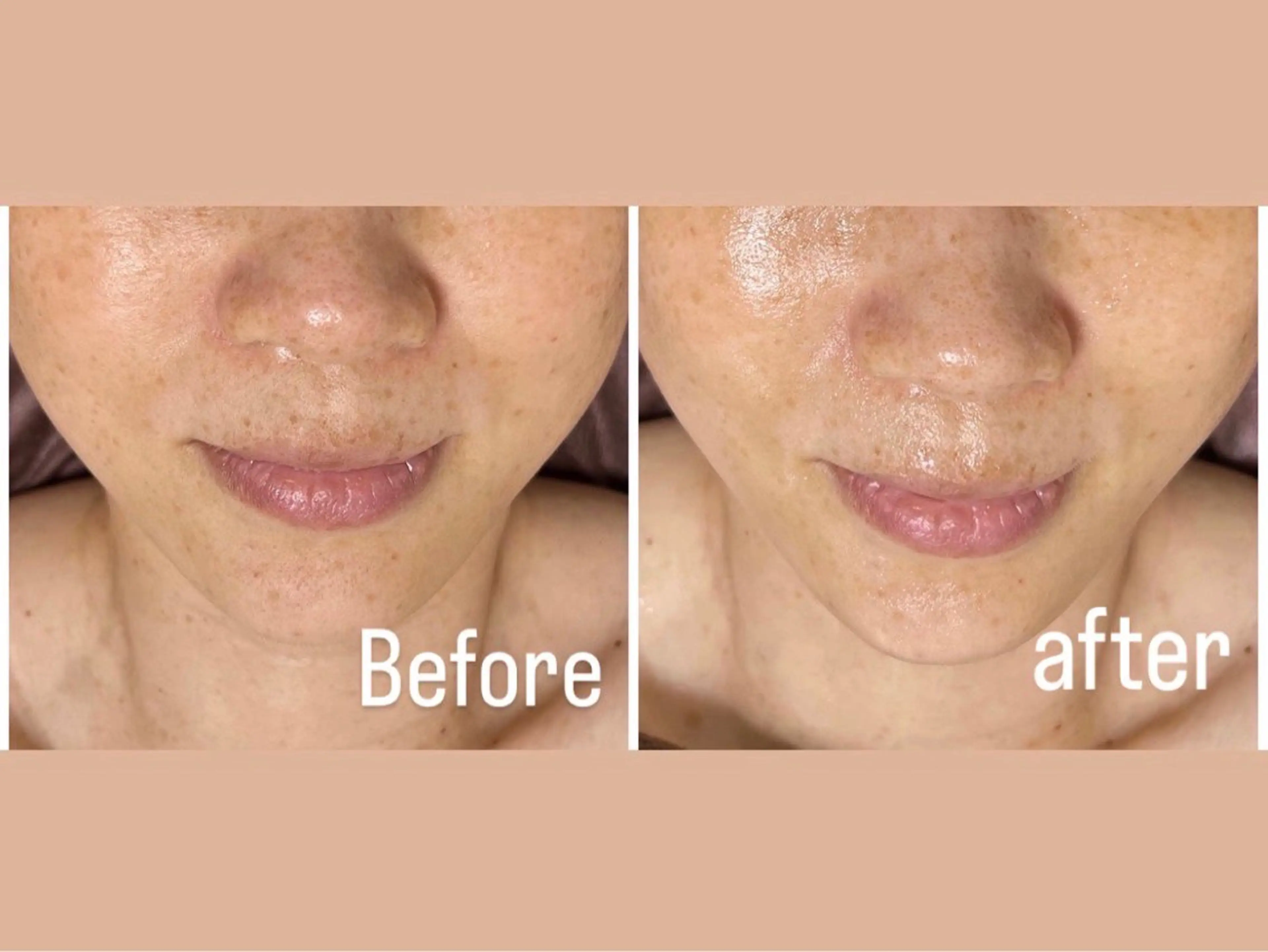 ピーリング＆脱毛 maoのエステ・リラクイメージ