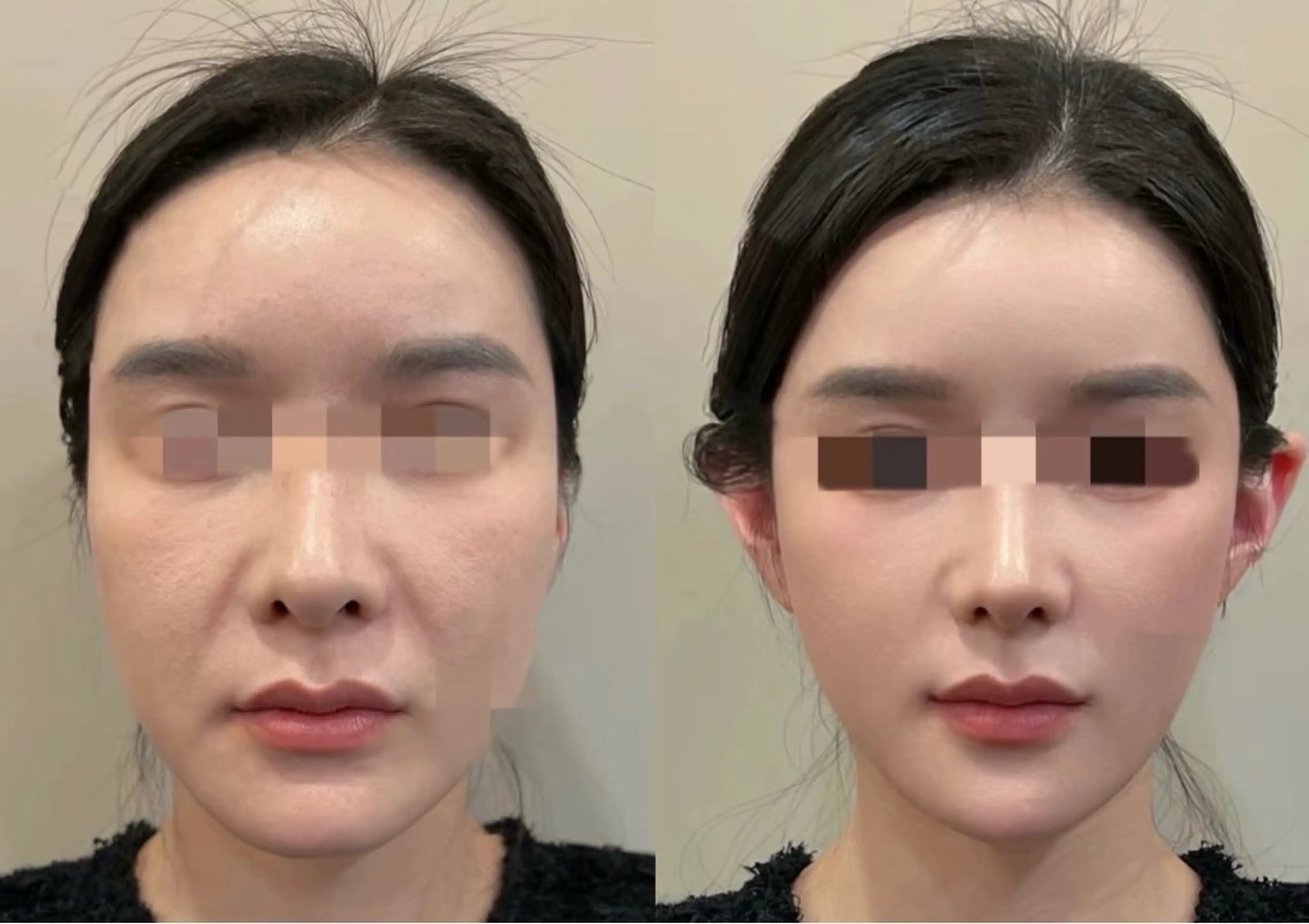 エステ リラク 愛維美水光美肌専門店所属・愛維美水光美肌専門店 メンズレディースokのエステ・リラクイメージ