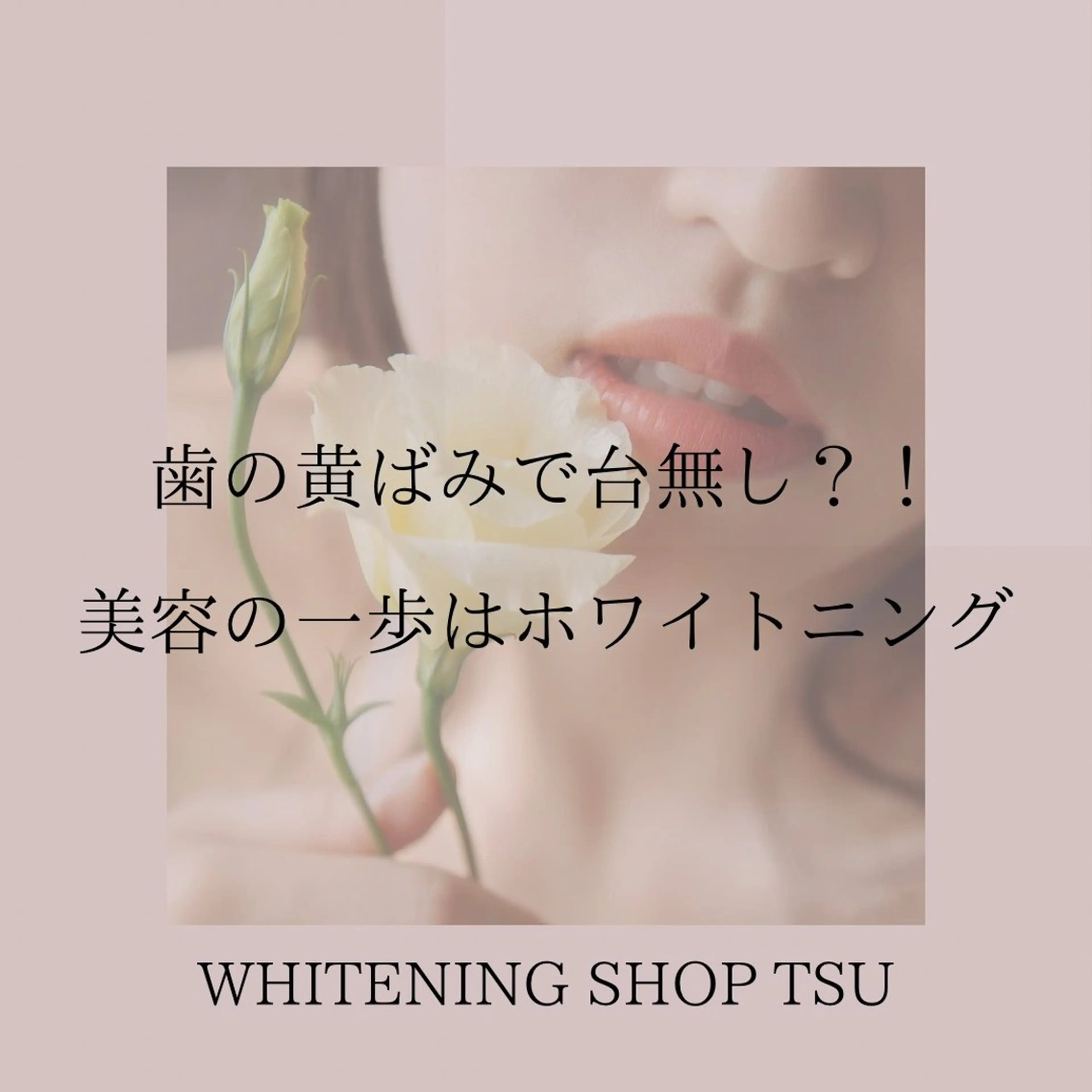 ホワイトニングショップ津店所属・ホワイトニング ショップ津店のその他イメージ