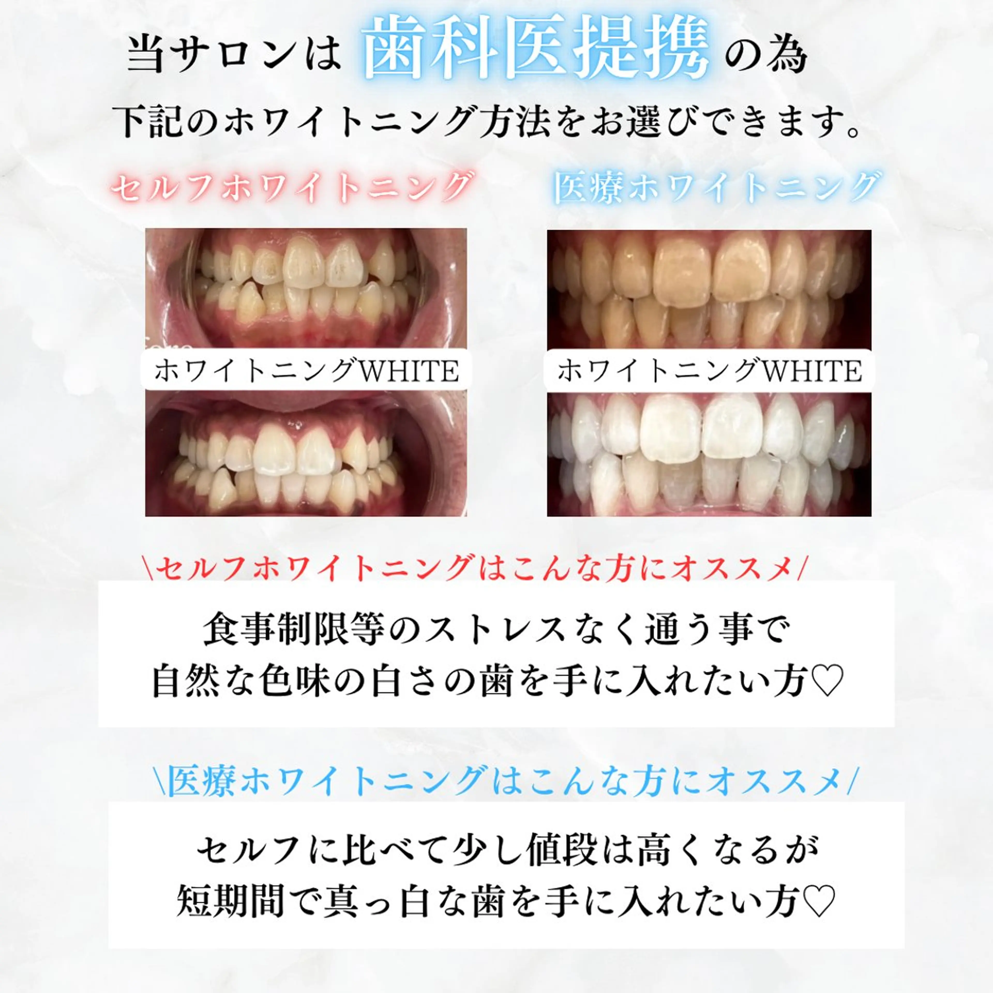 メンズ ホワイトニング専門店 WHITE天神店のエステ・リラクイメージ