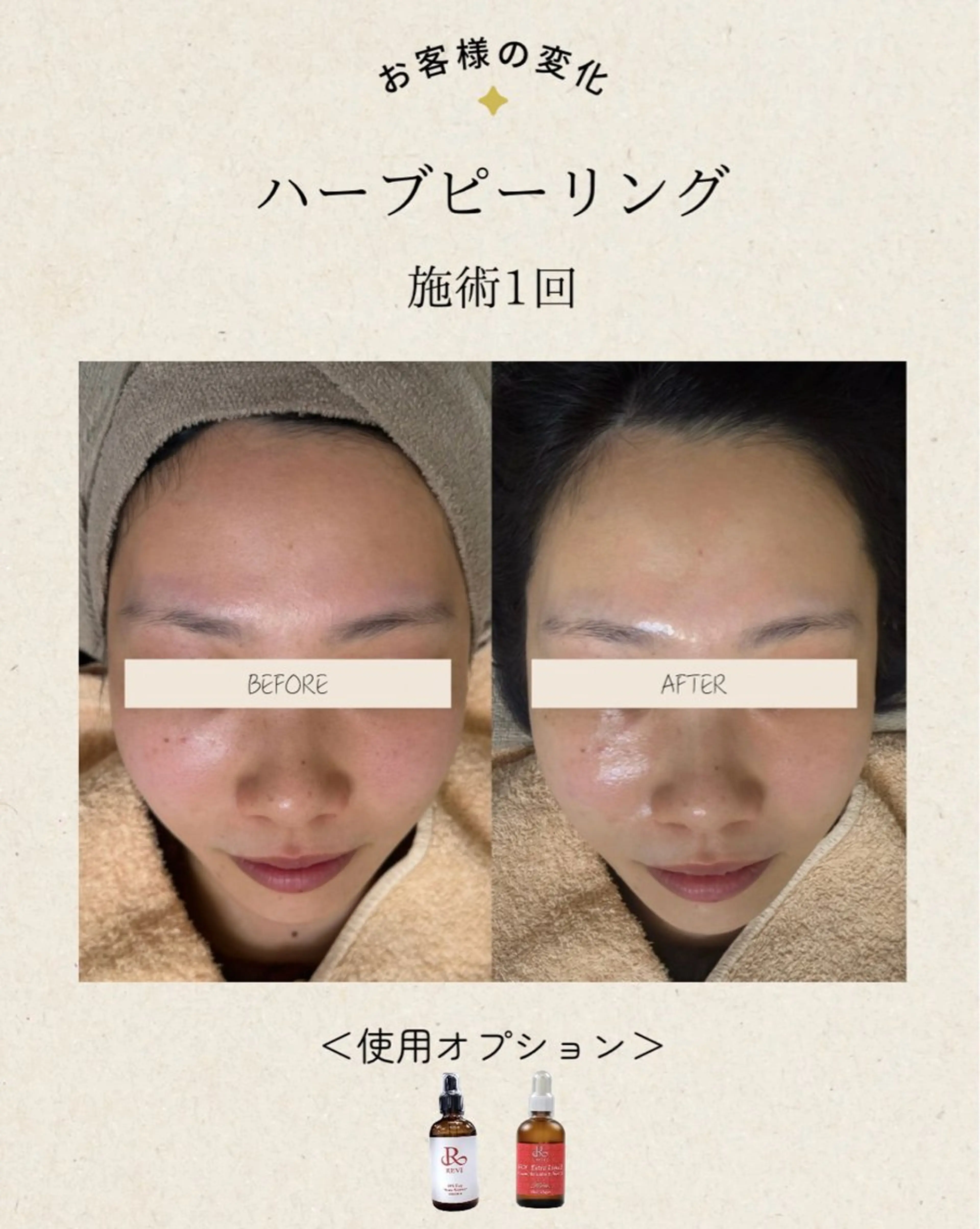 エステ リラク Monart -deux-のエステ・リラクイメージ