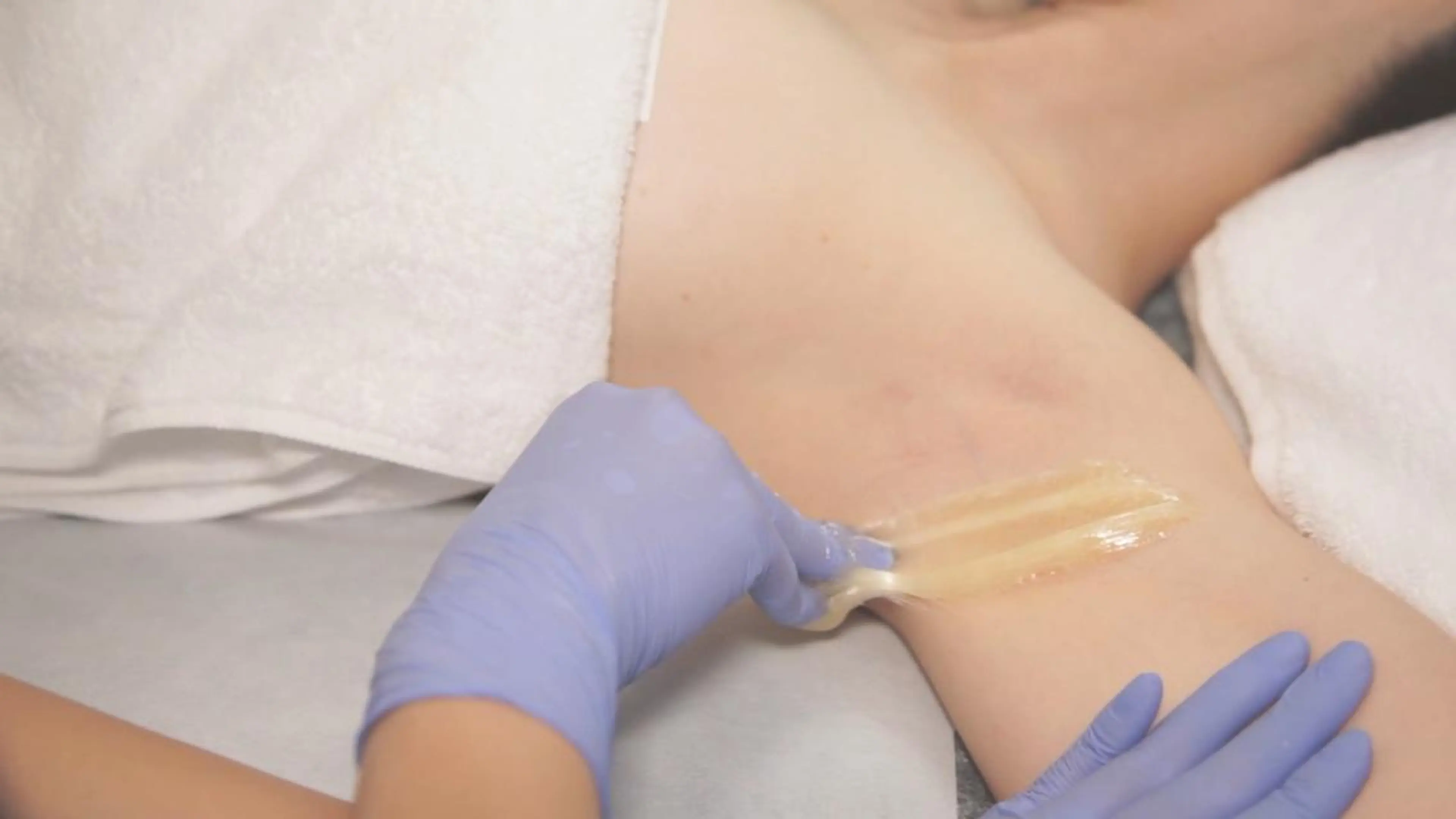 【新規】シュガーリング脱毛 脇 　3000円 ♥minimoお気に入り登録者のみ♥の写真