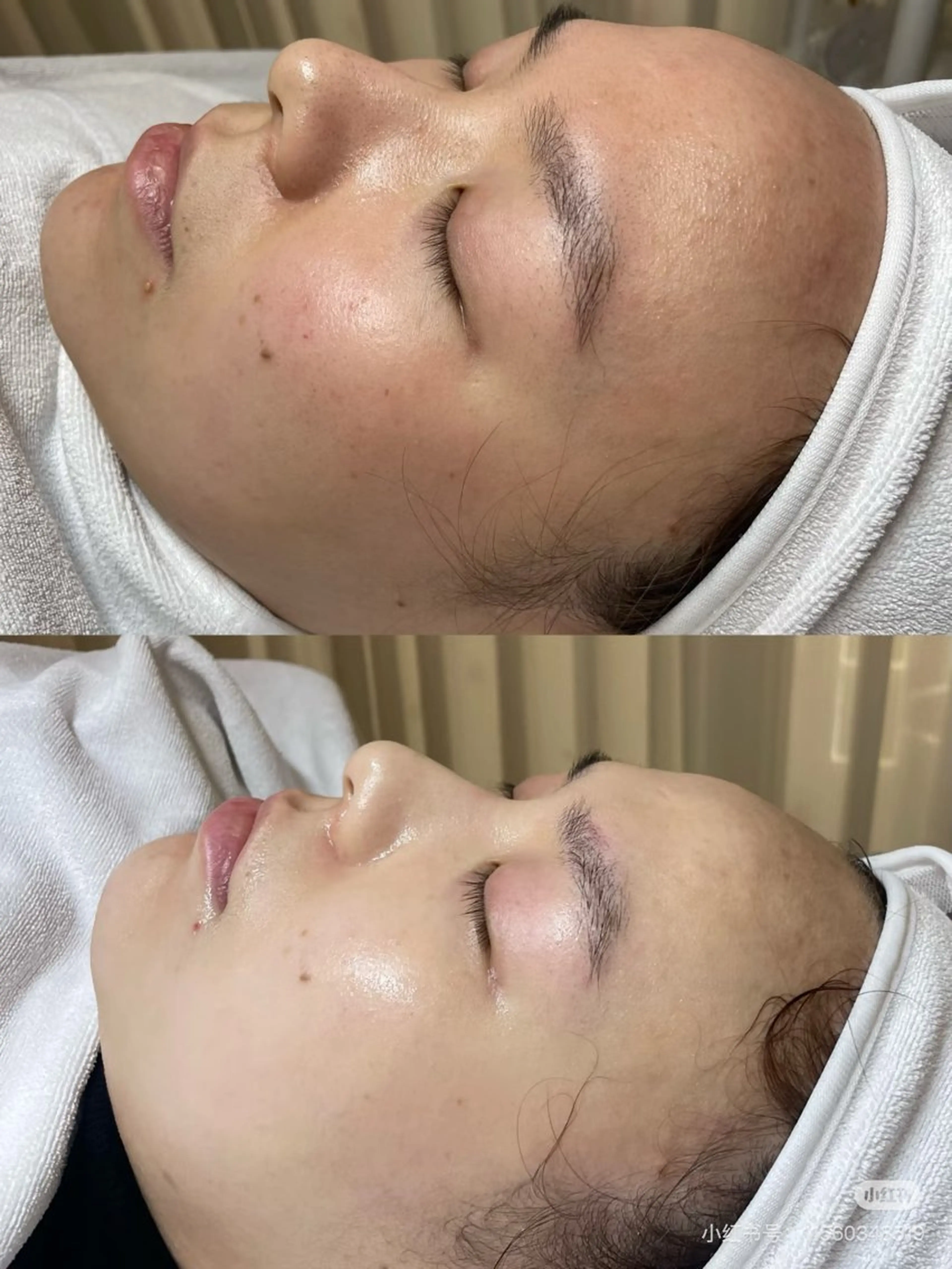 ネイル エステ aliaハイフ&水光ジェットサロン所属・aliaハーブ水光店 エステティシャン募集のエステ・リラクイメージ