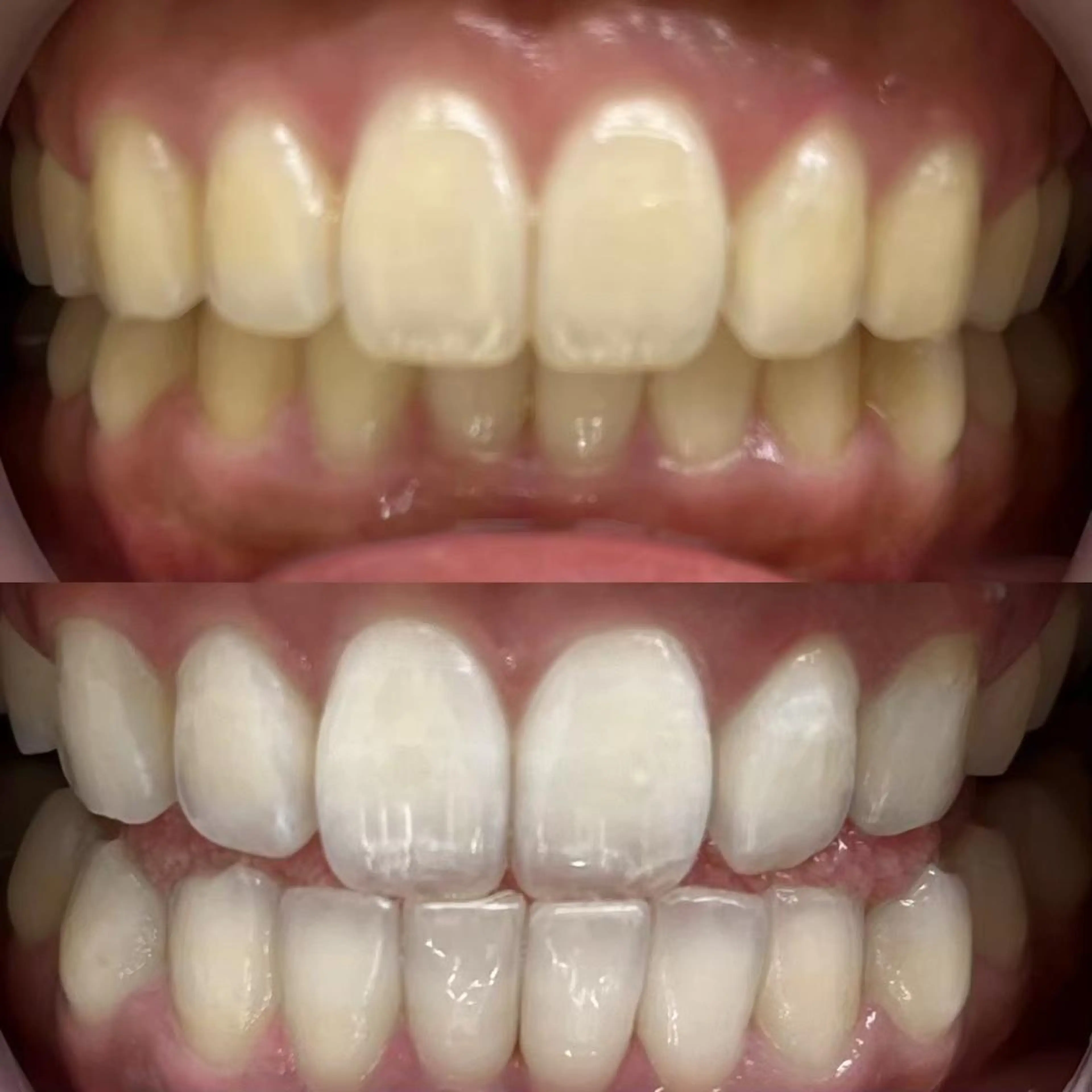 LBSホワイトニング 銀座店💎スタッフ峯のその他イメージ