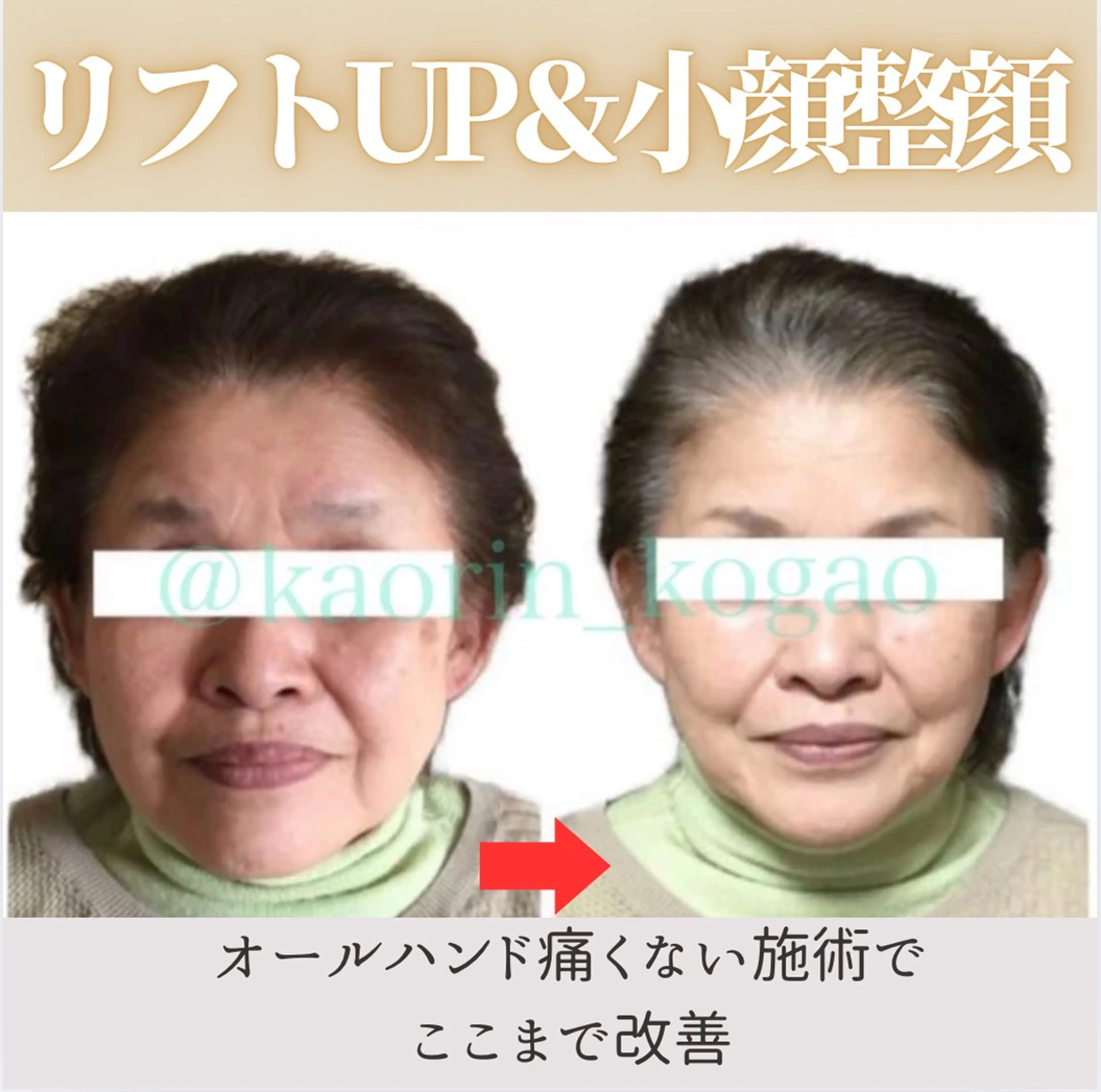 小顔矯正サロン顔凛 KANAのエステ・リラクイメージ