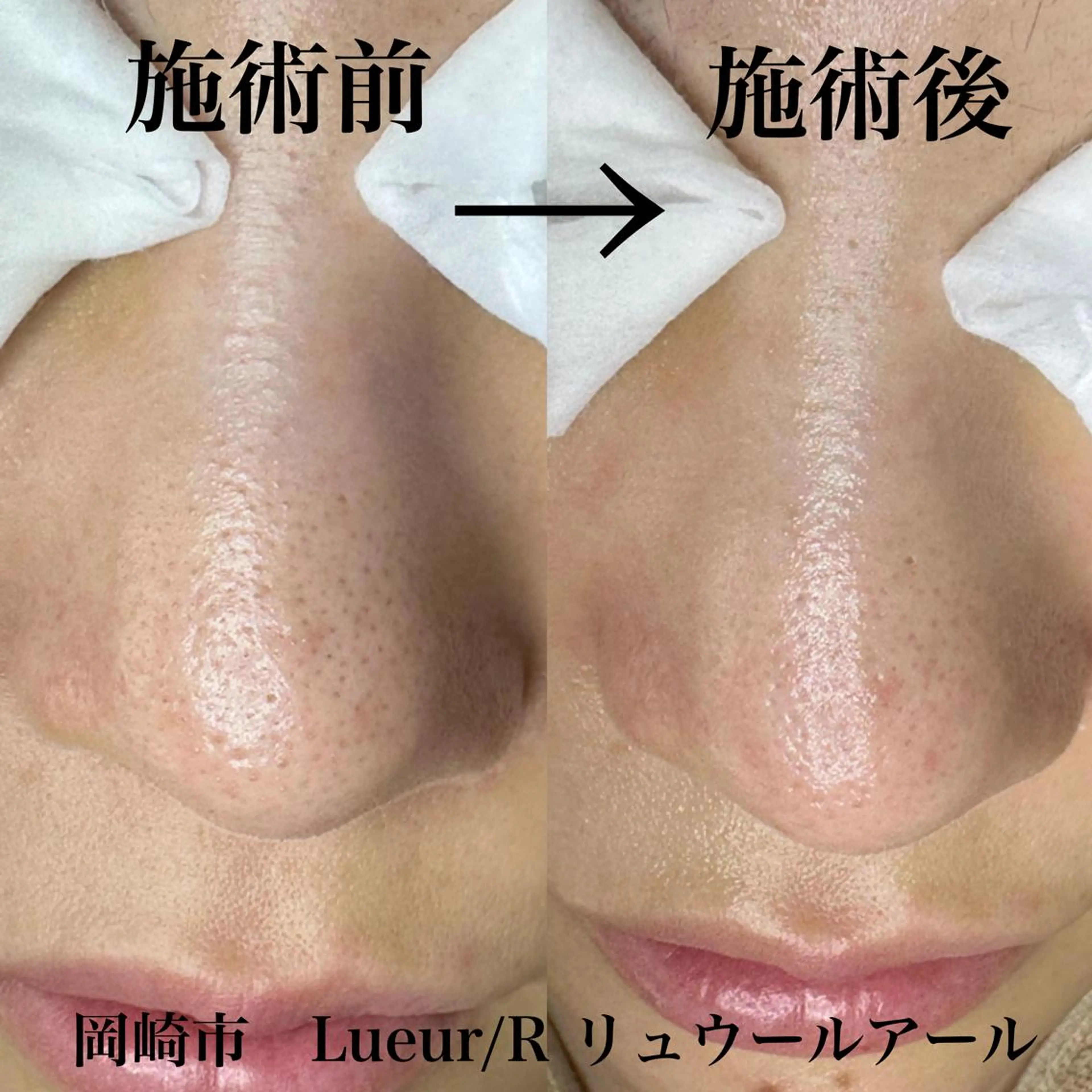 エステ 大久保 里奈のエステ・リラクイメージ