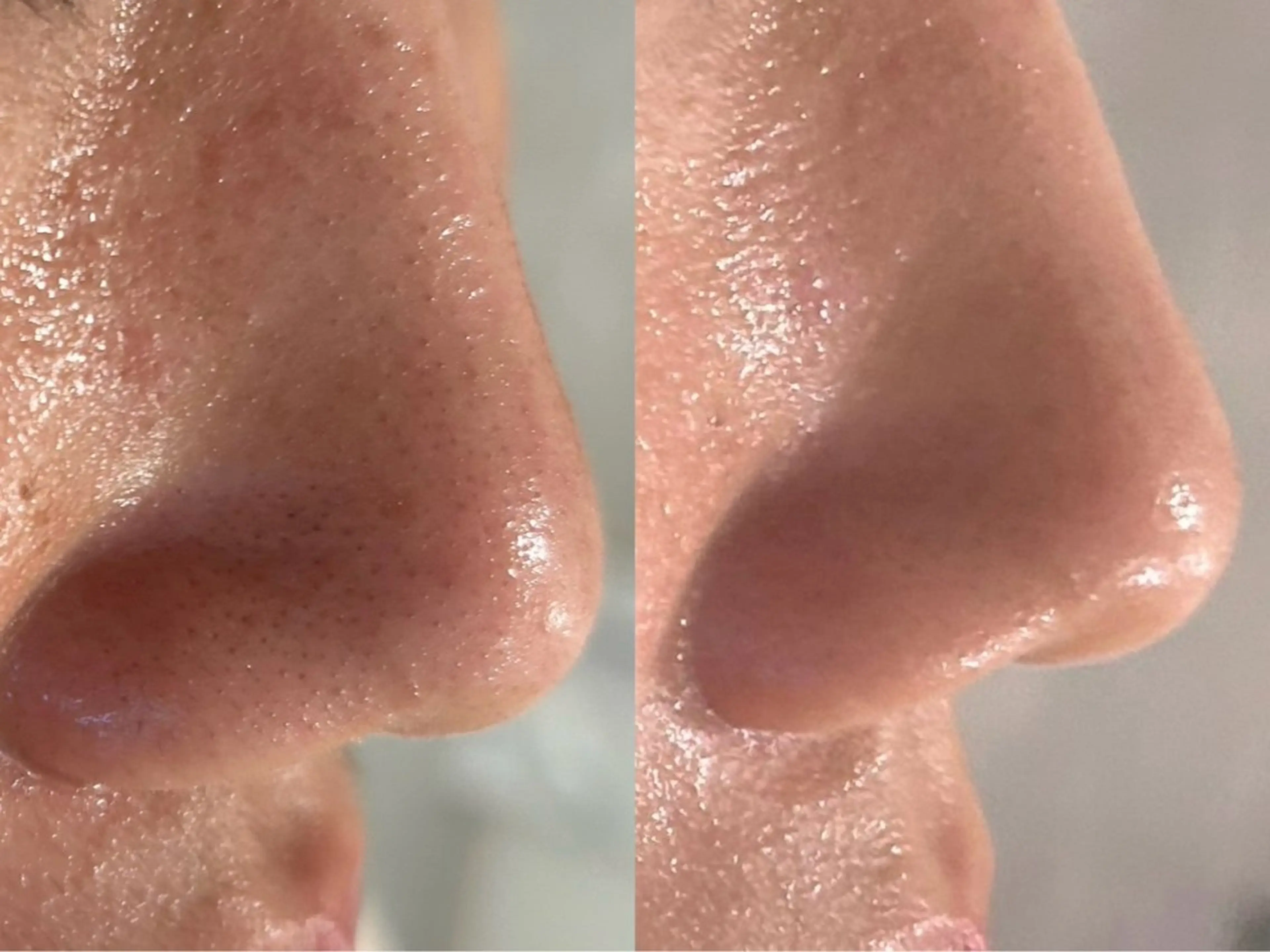 【都度払い脱毛 美肌脱毛】馬車道店のエステ・リラクイメージ