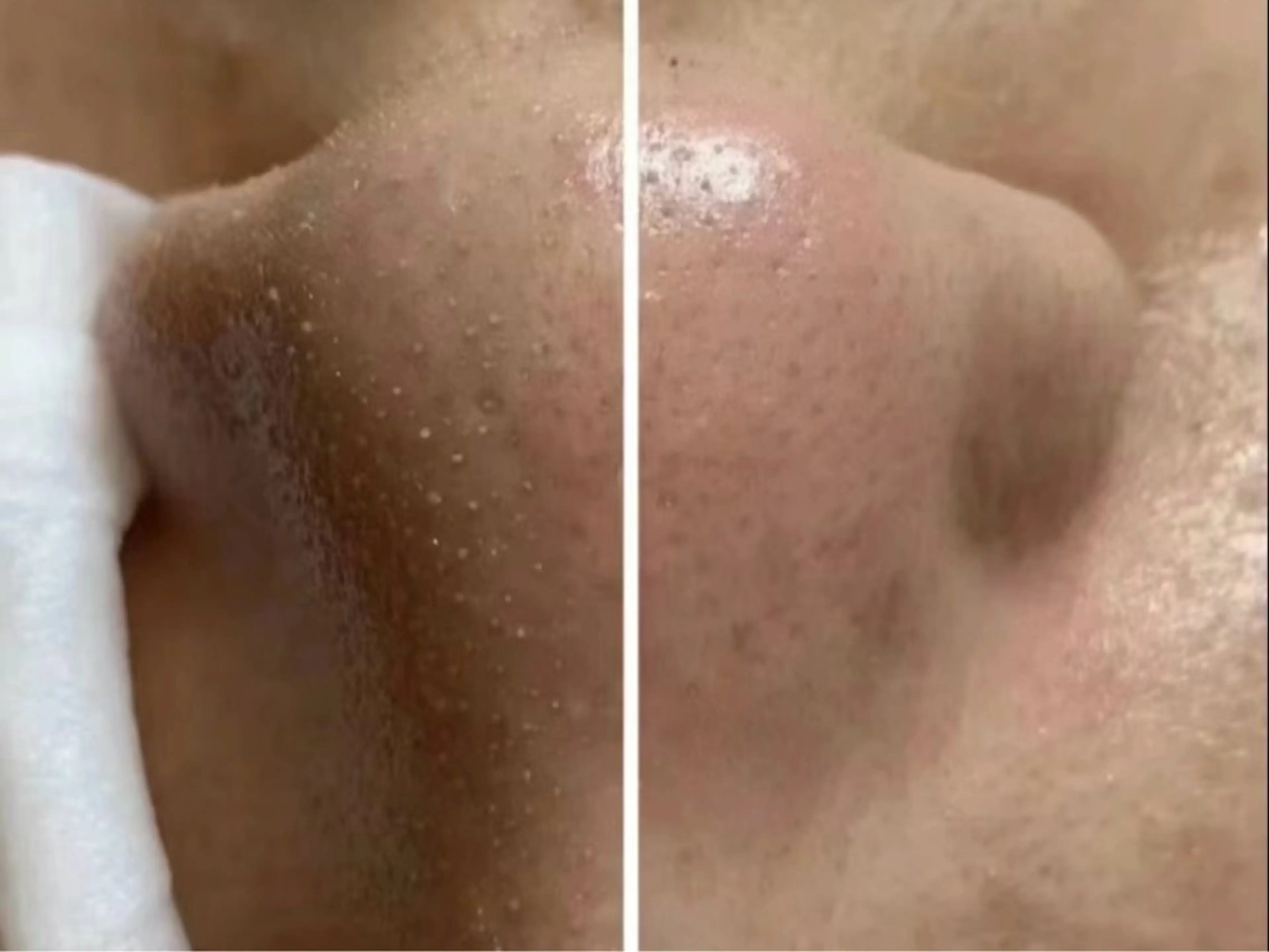 Nature Souce毛穴専門店のその他イメージ