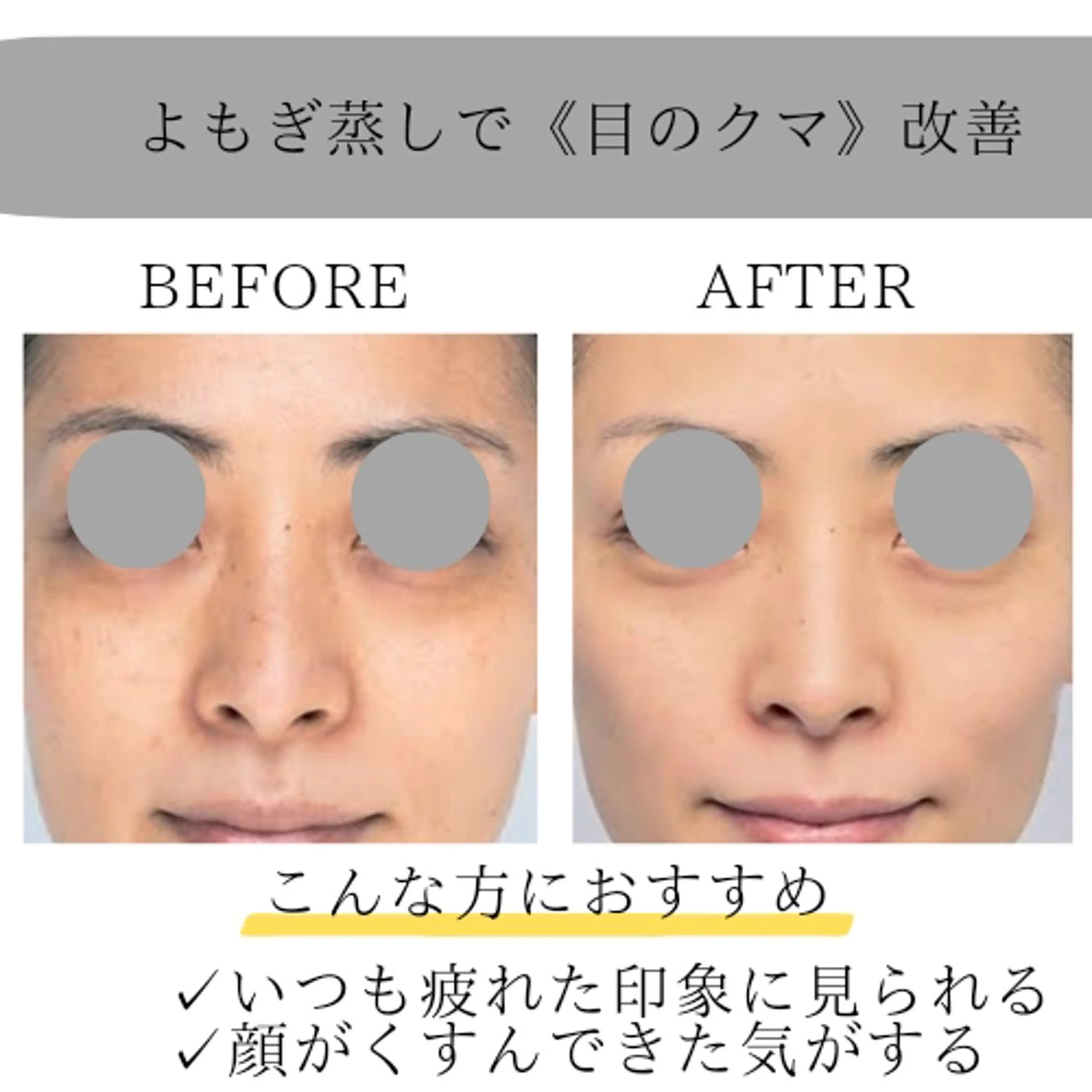 ホワイトニングサロン ネージュ(女性専用)のその他イメージ