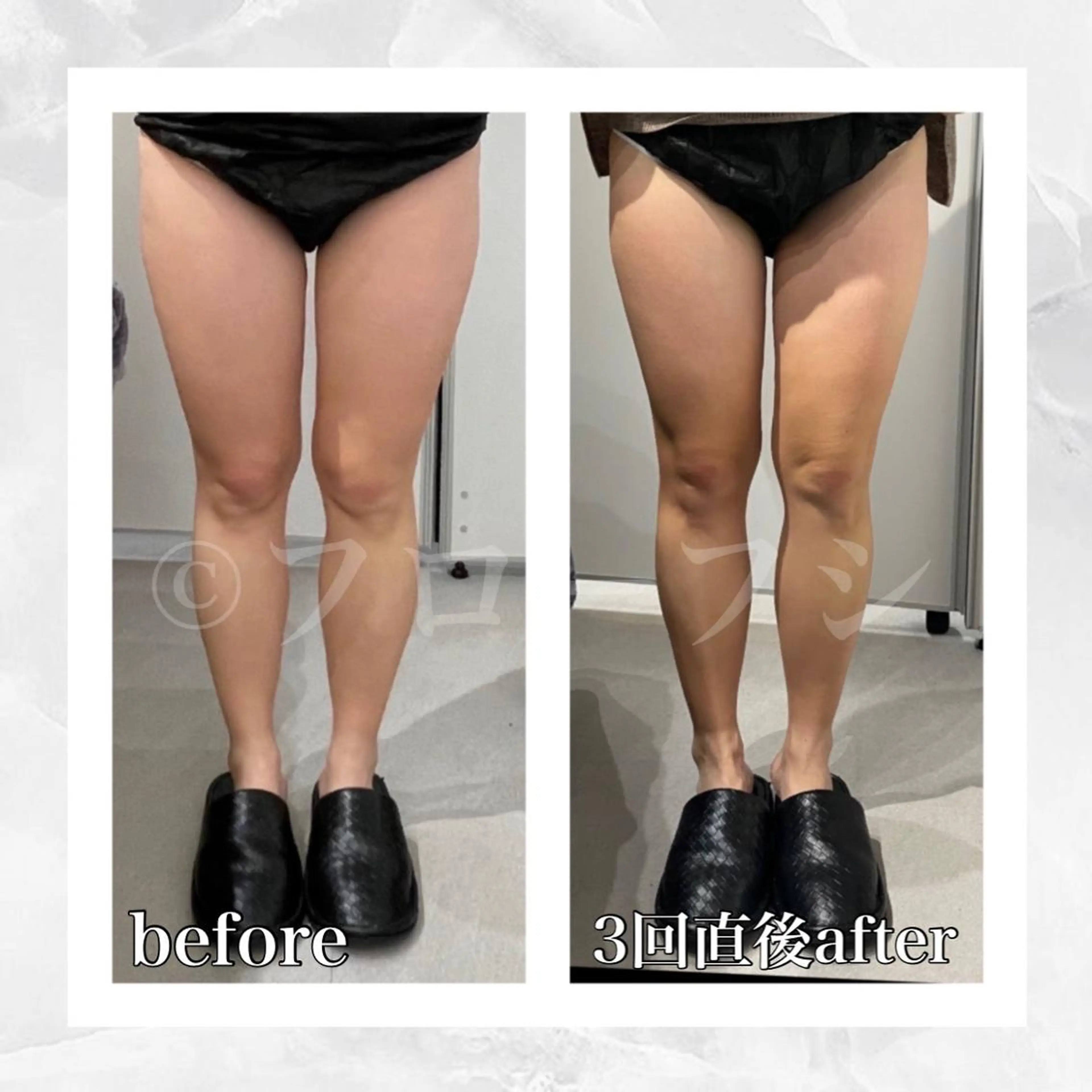 エステ リラク 部分痩せ♥️小顔専門 MIKUのエステ・リラクイメージ