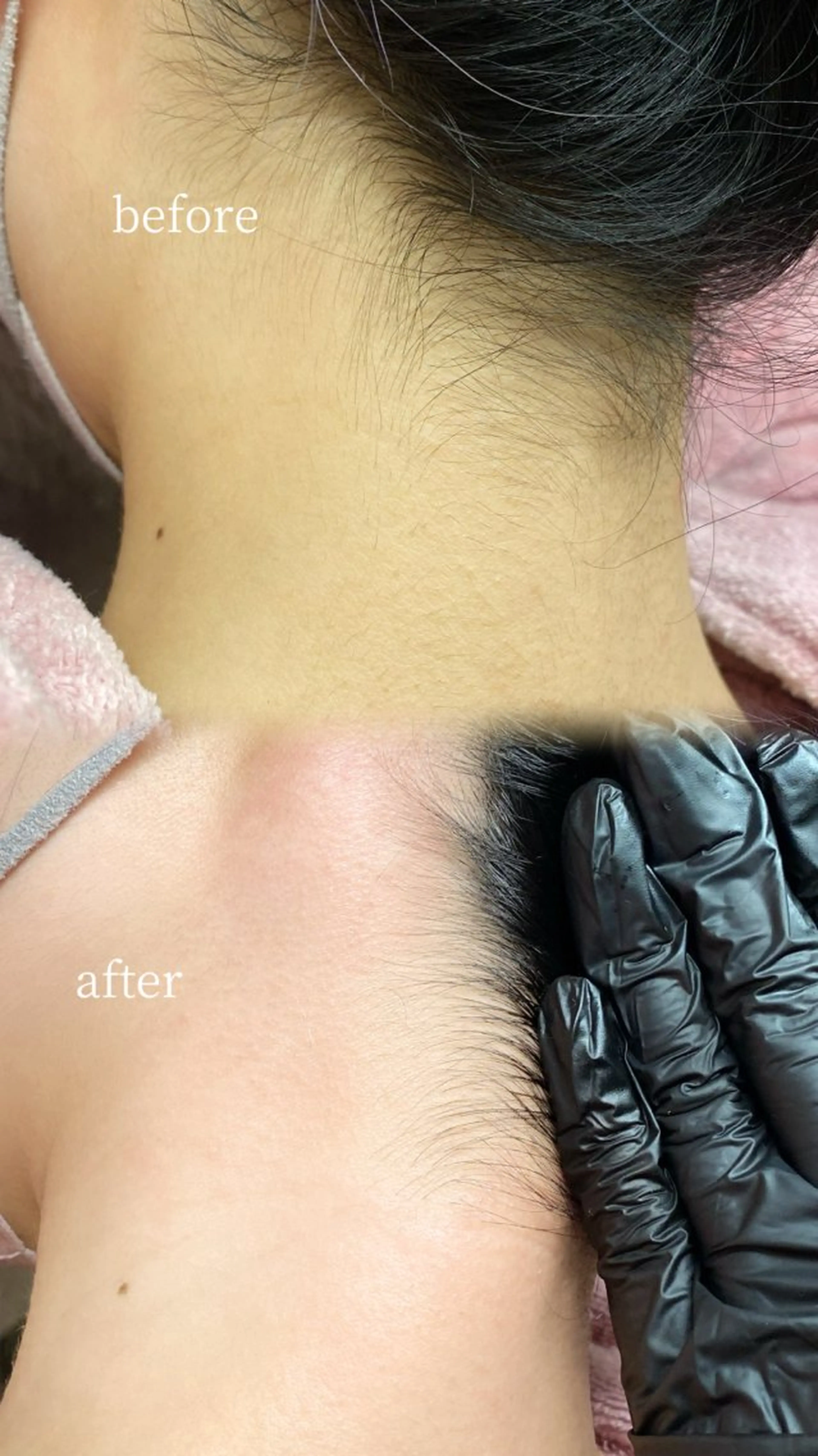 【初回限定】新HBL＋うなじWAX脱毛セット 美眉×美うなじで写真映え◎ ¥6900→¥6500の写真