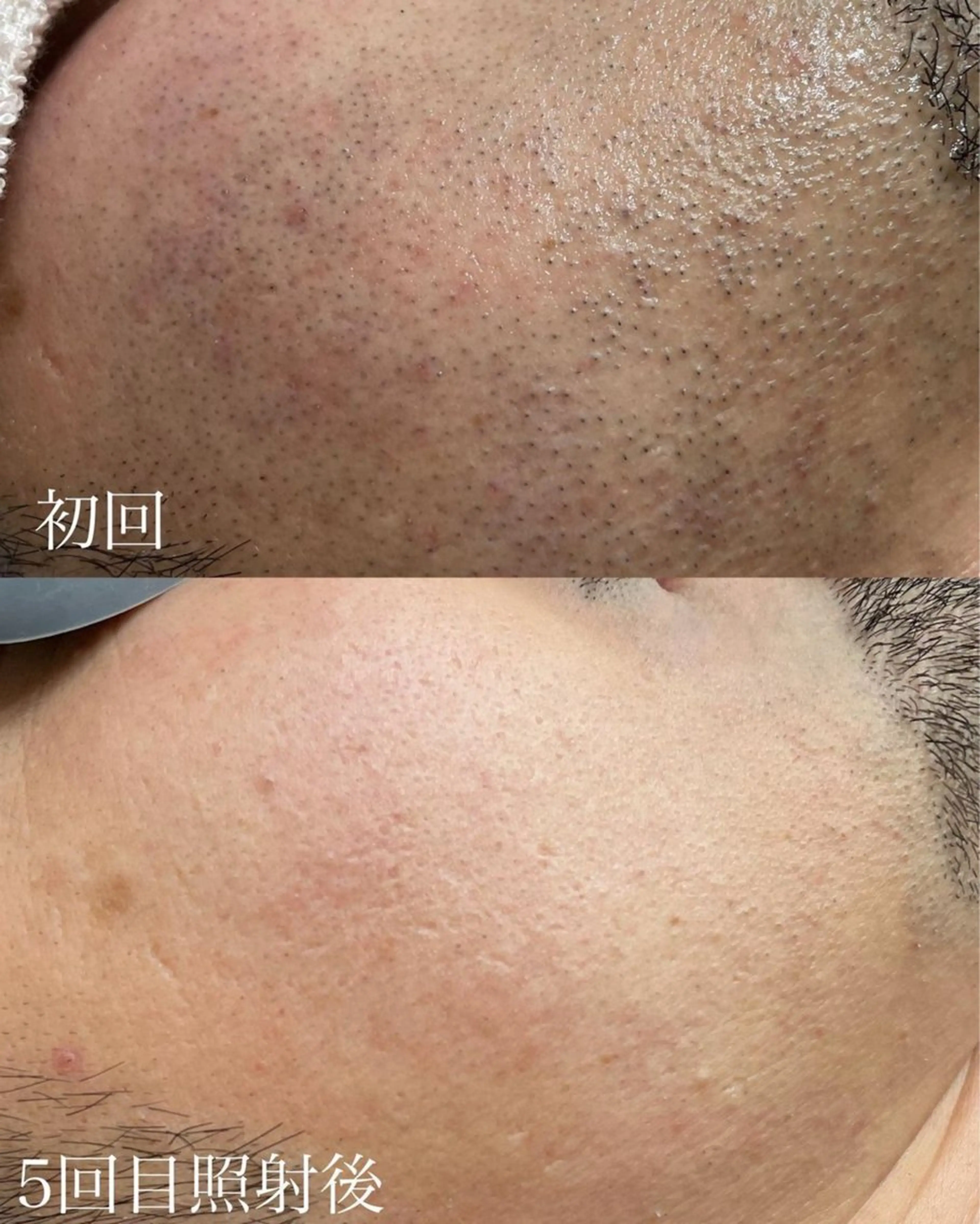 メンズ EARTH coiffure beaute 小山店所属・EARTH 小山店 shimaのエステ・リラクイメージ