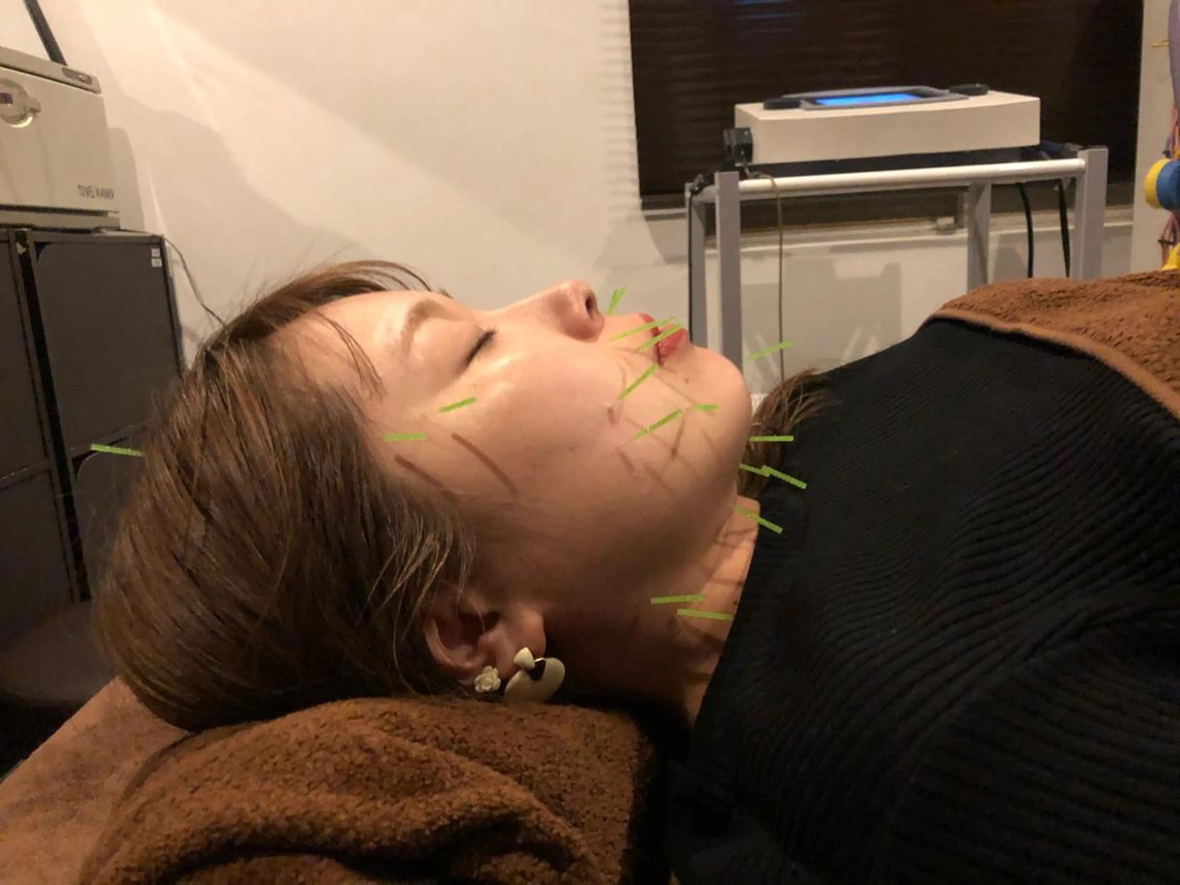 エステ リラク 美容鍼灸サロン LOMIHARIのエステ・リラクイメージ