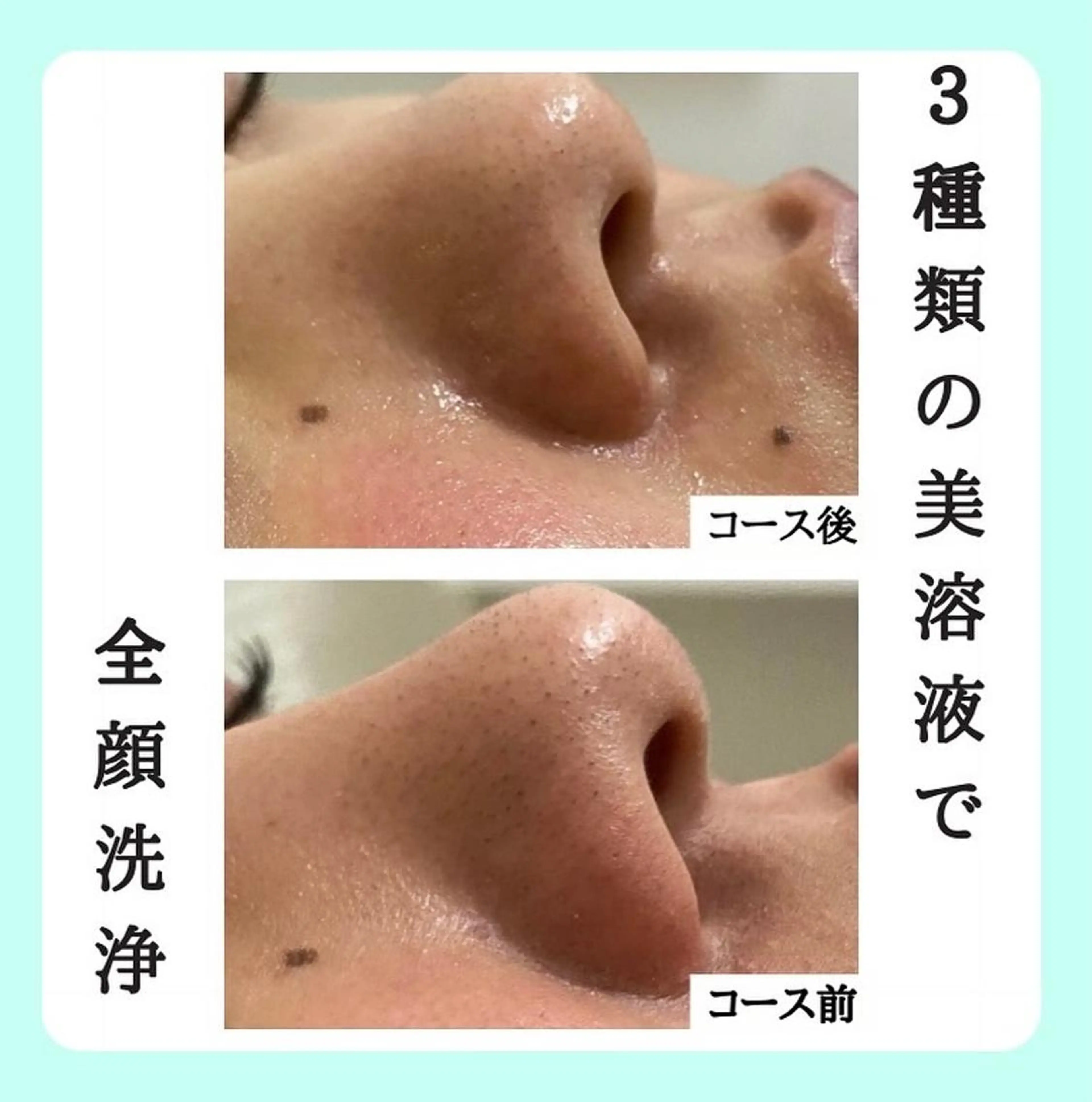 aisea（アイシー）所属・アイシー 〜大人の毛穴ツヤ肌〜のエステ・リラクイメージ