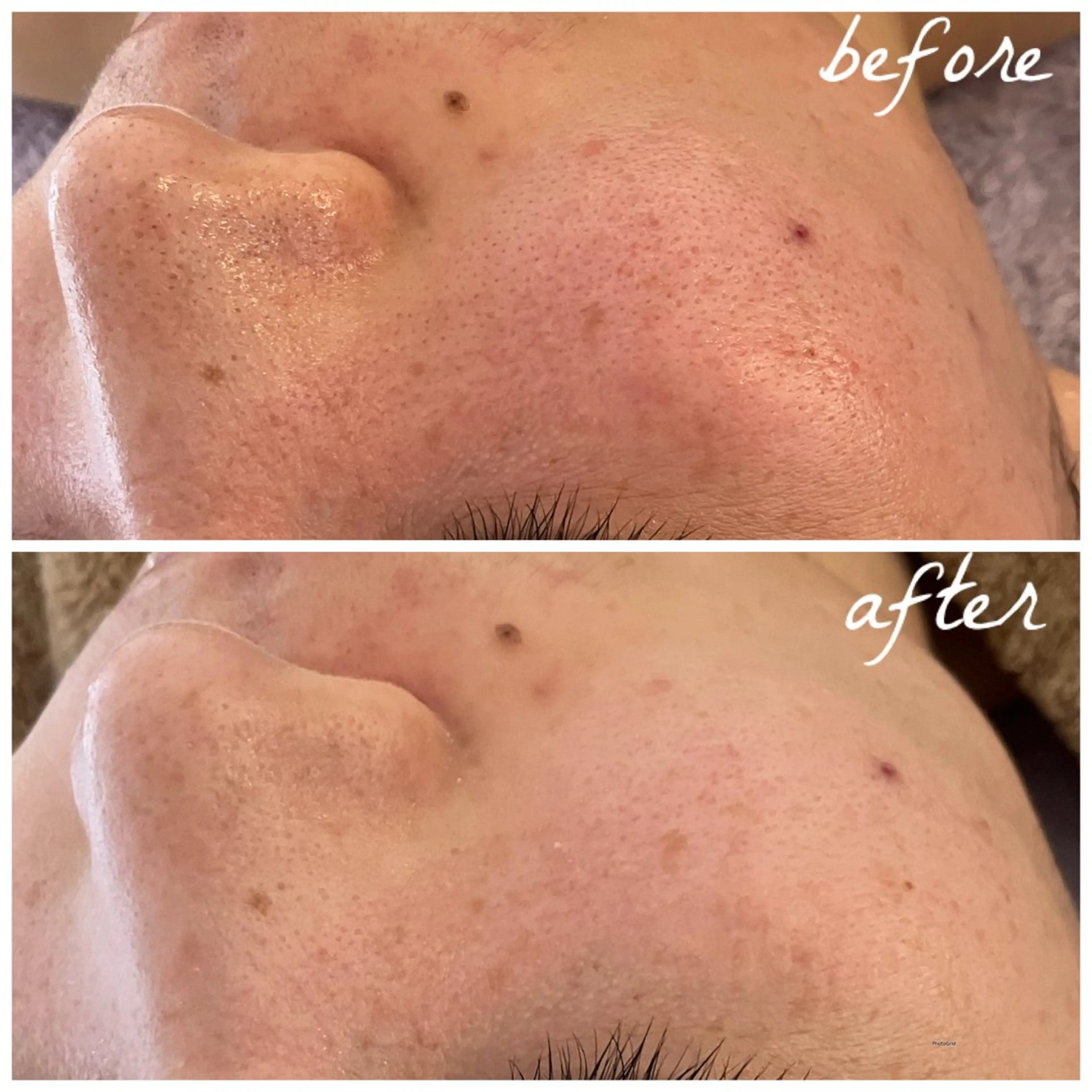 メンズ エステ メナード岐阜茜部 杉浦のエステ・リラクイメージ