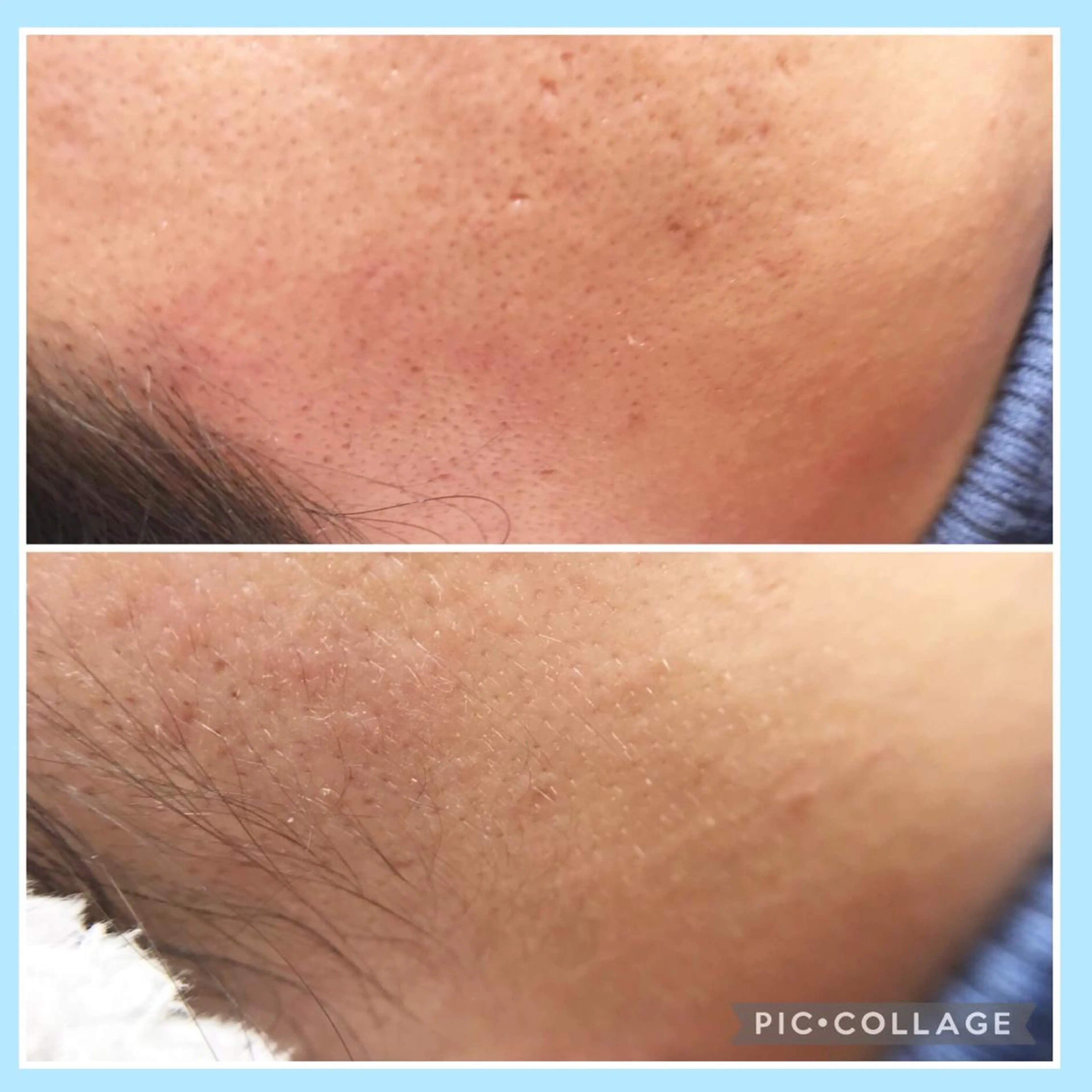 🥝フェイシャルワックスの写真