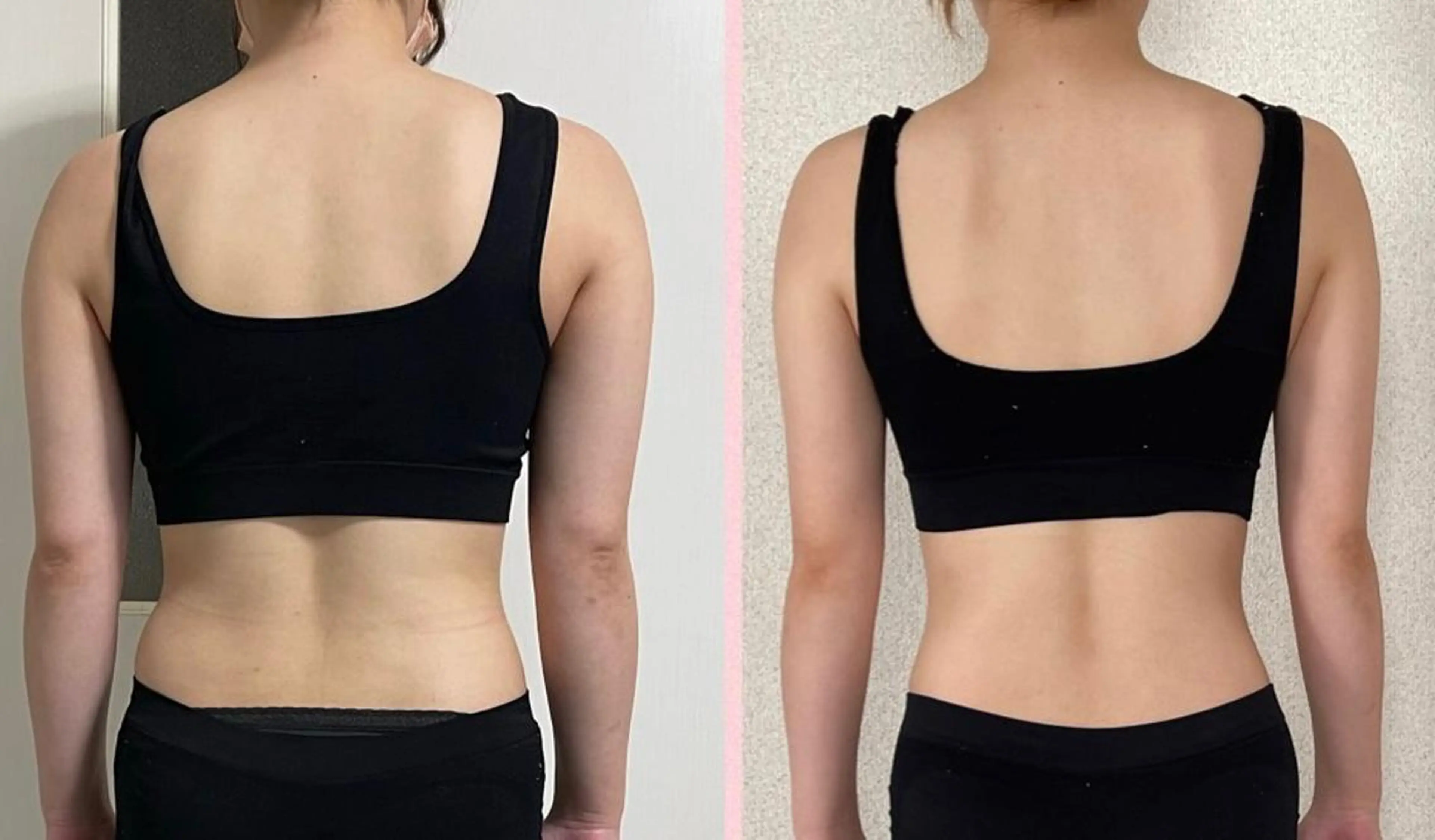 🌈女性限定🌈背中➕二の腕エステの写真