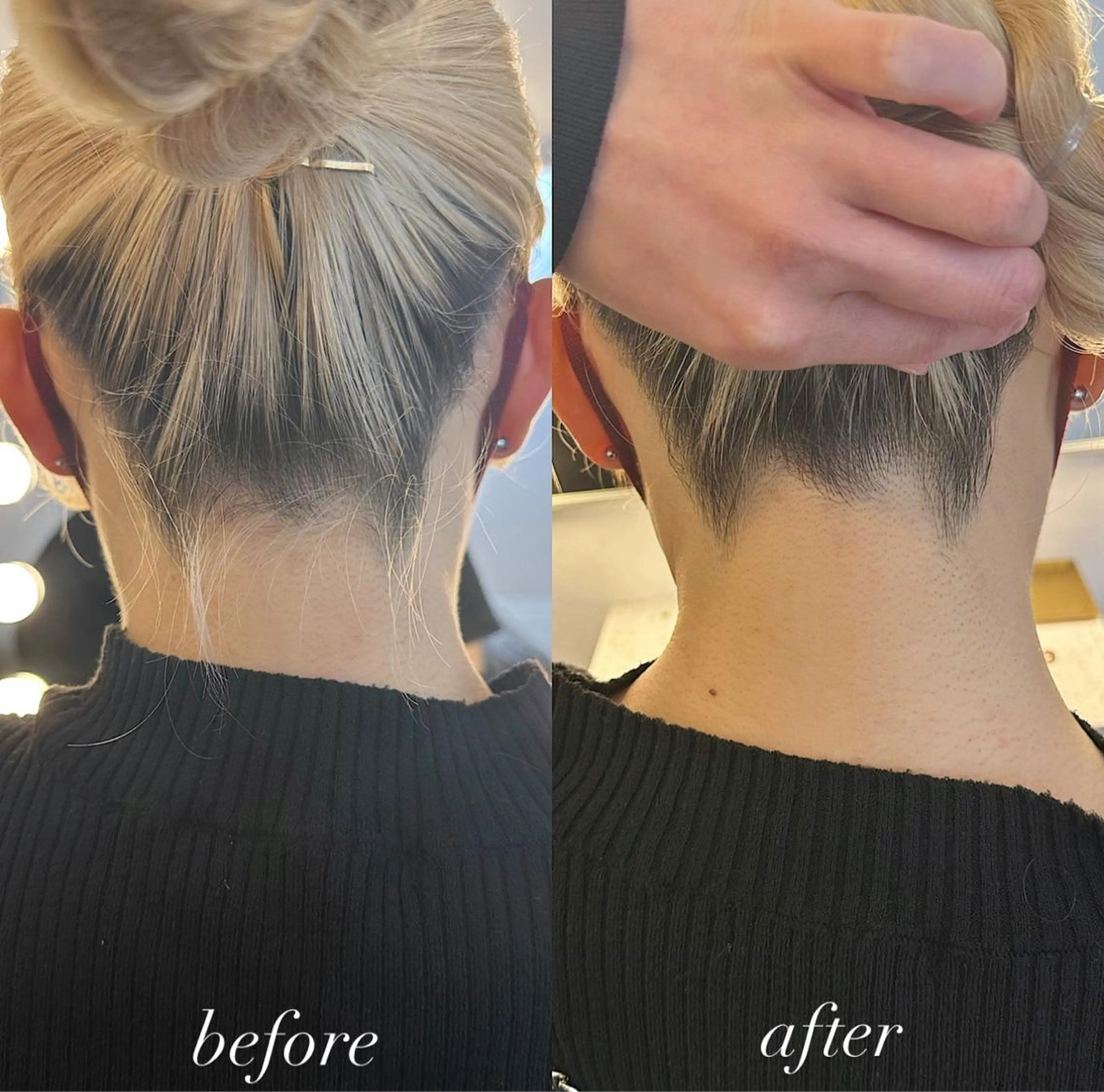 うなじ脱毛/美肌脱毛 LABELのエステ・リラクイメージ