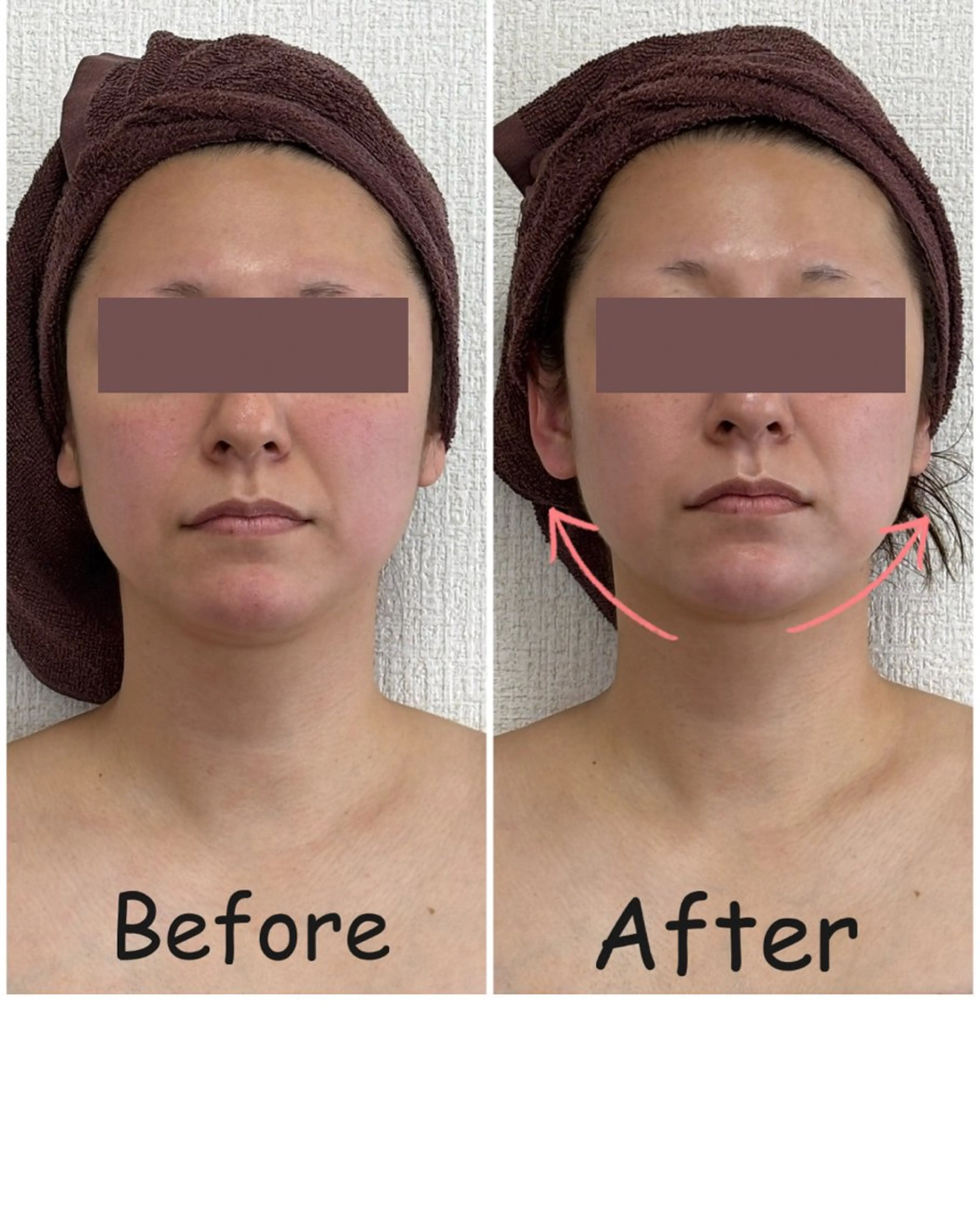 Eminy by  L★sのエステ・リラクイメージ