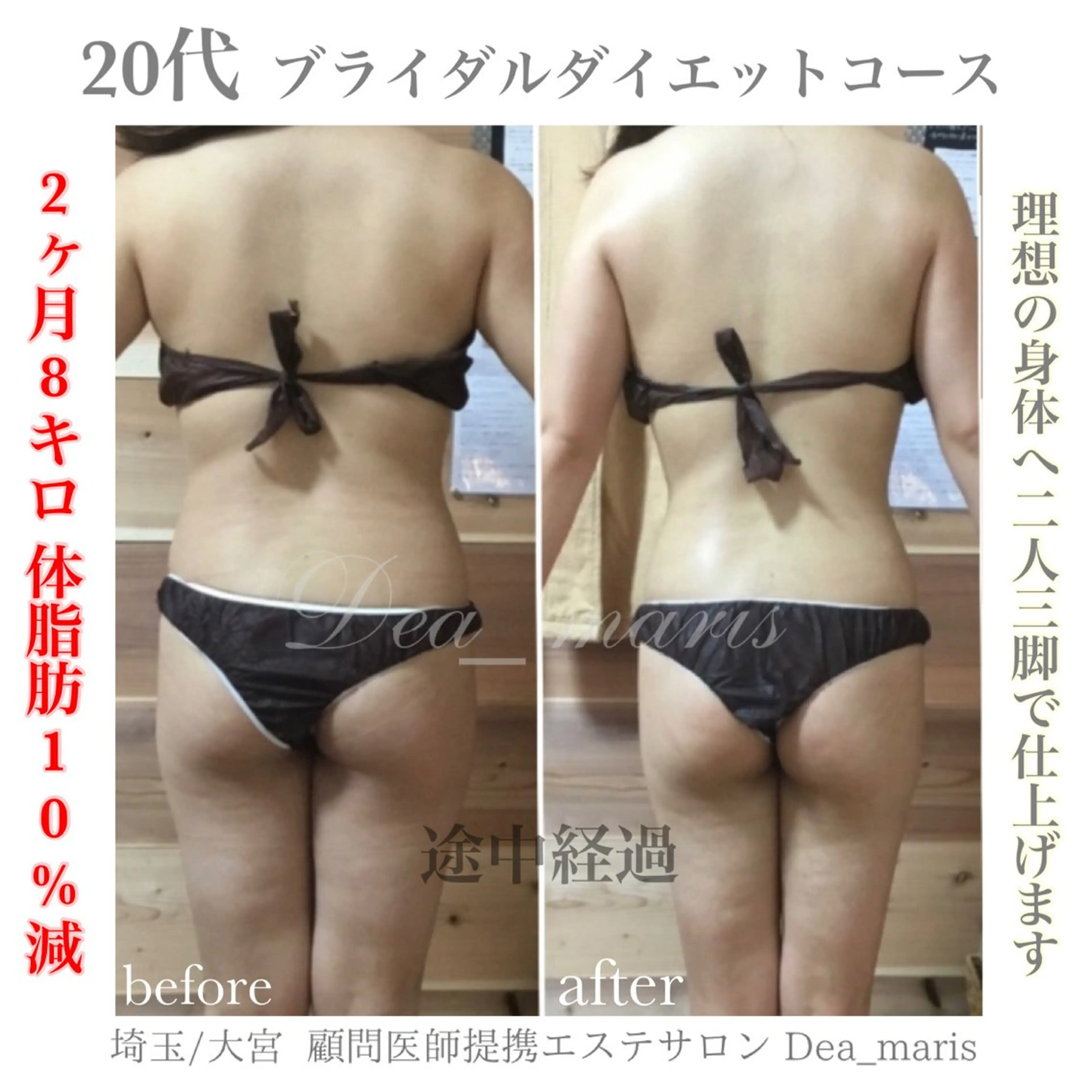 private salon  Dea_maris シュガーリング＆パーソナルボディケア所属・シミ改善・韓国肌管理 ボディメイク痩身のその他イメージ