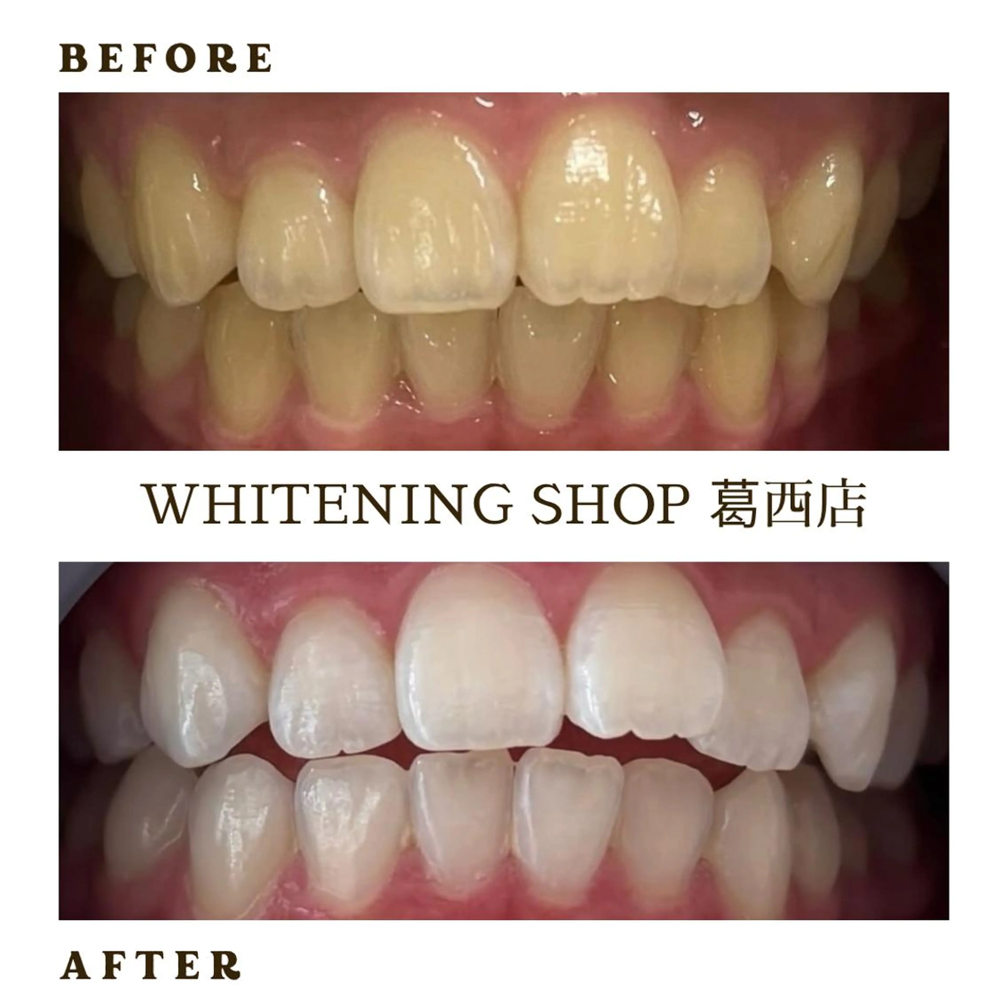 メンズ その他 ホワイトニング ショップ葛西店のその他イメージ