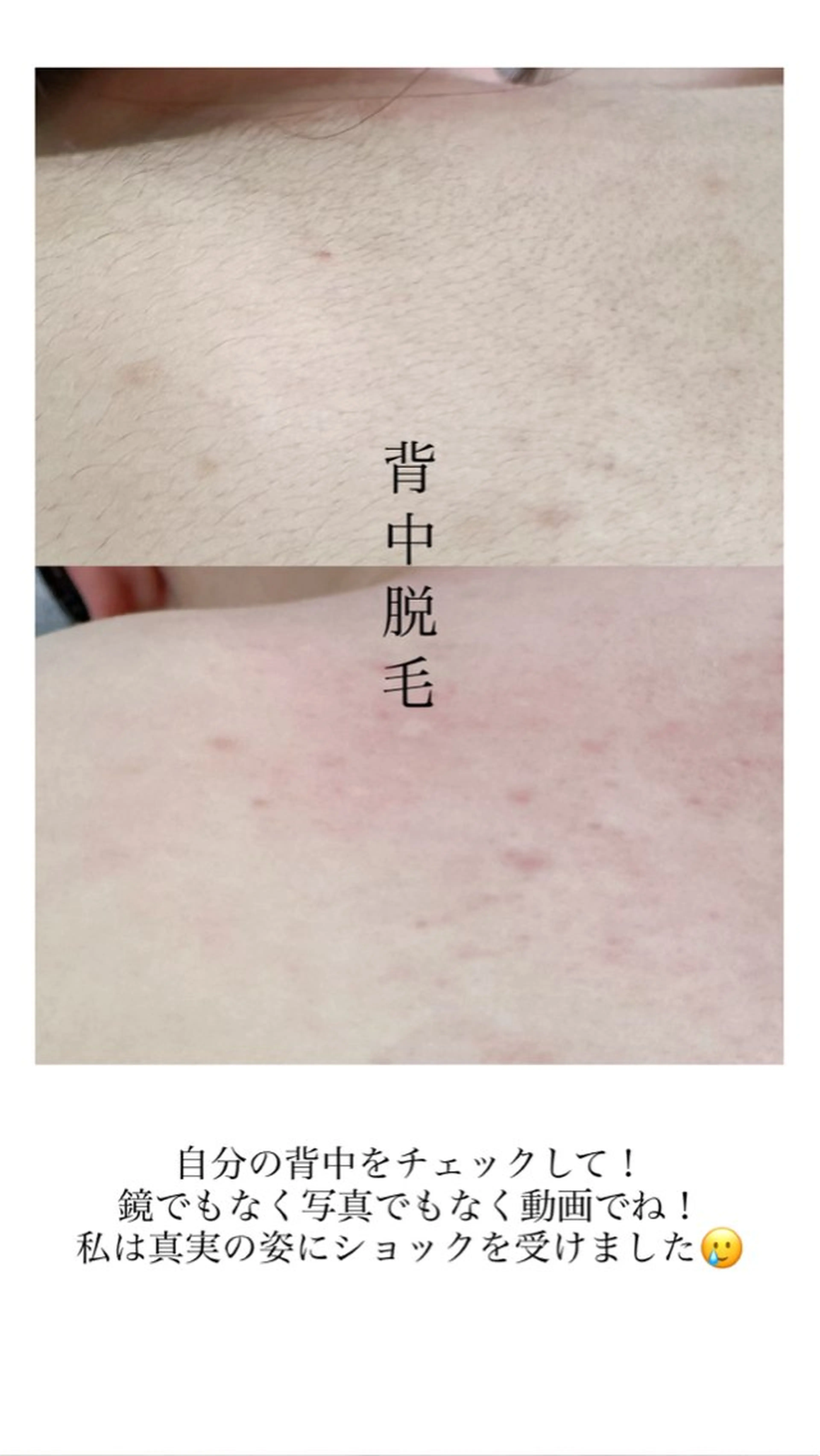 Hit. シュガーリング豊橋のエステ・リラクイメージ