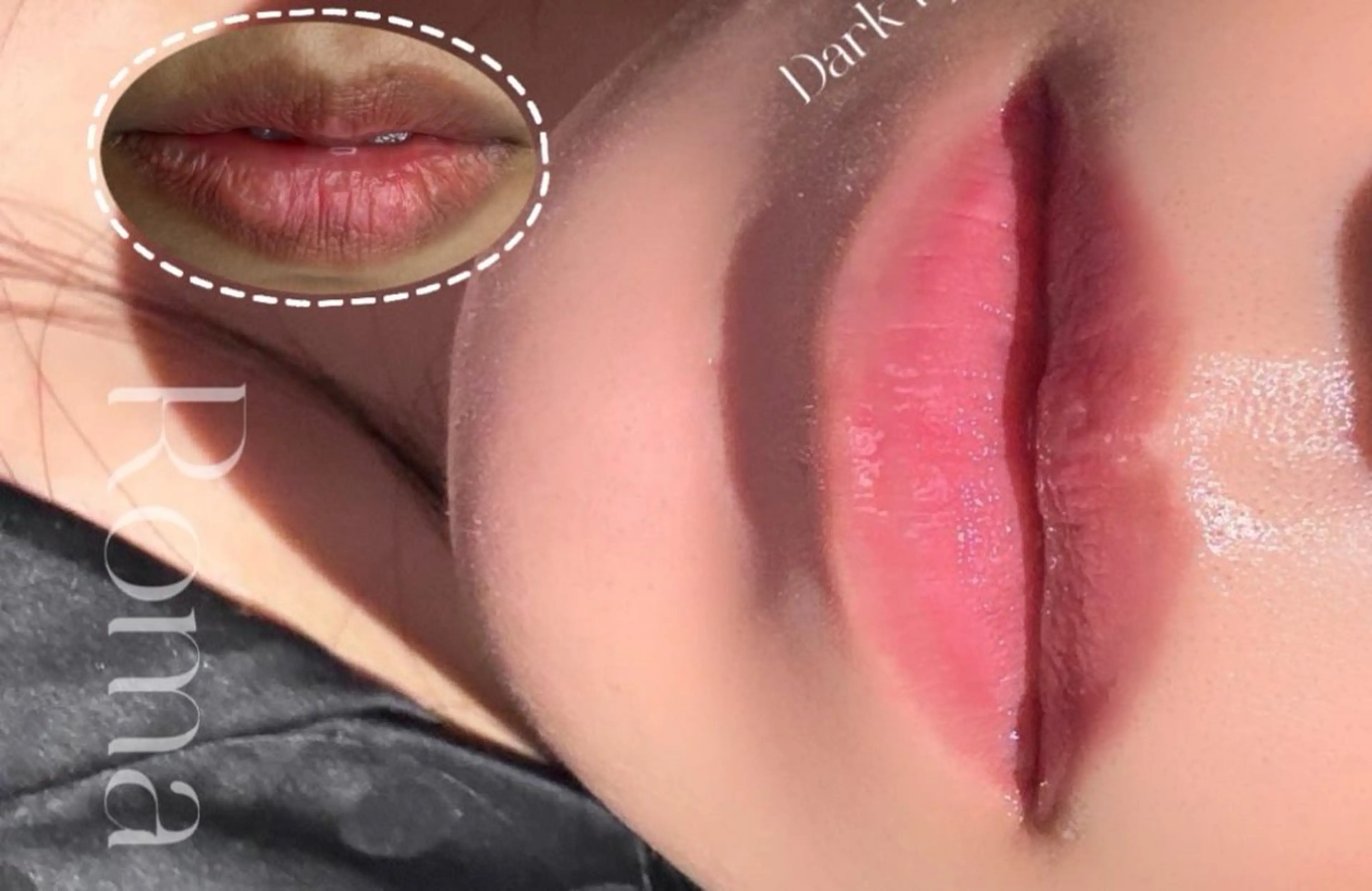 小顔/たるみ/黒ずみ除去専門サロン/SONA 大和西大寺店所属・【小顔専門看護師 サロンSONA】のエステ・リラクイメージ