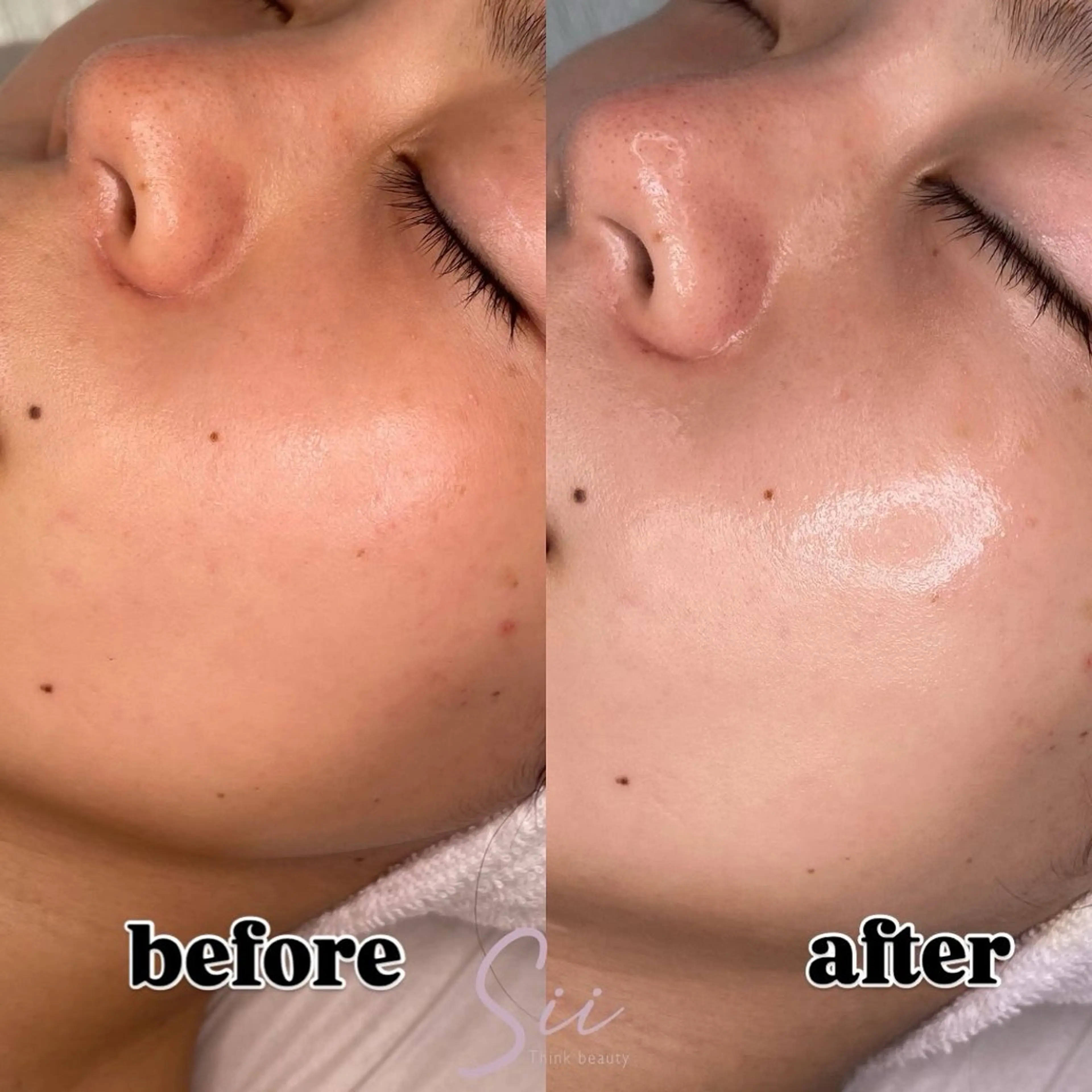 エステ エステサロン グラマラスのエステ・リラクイメージ