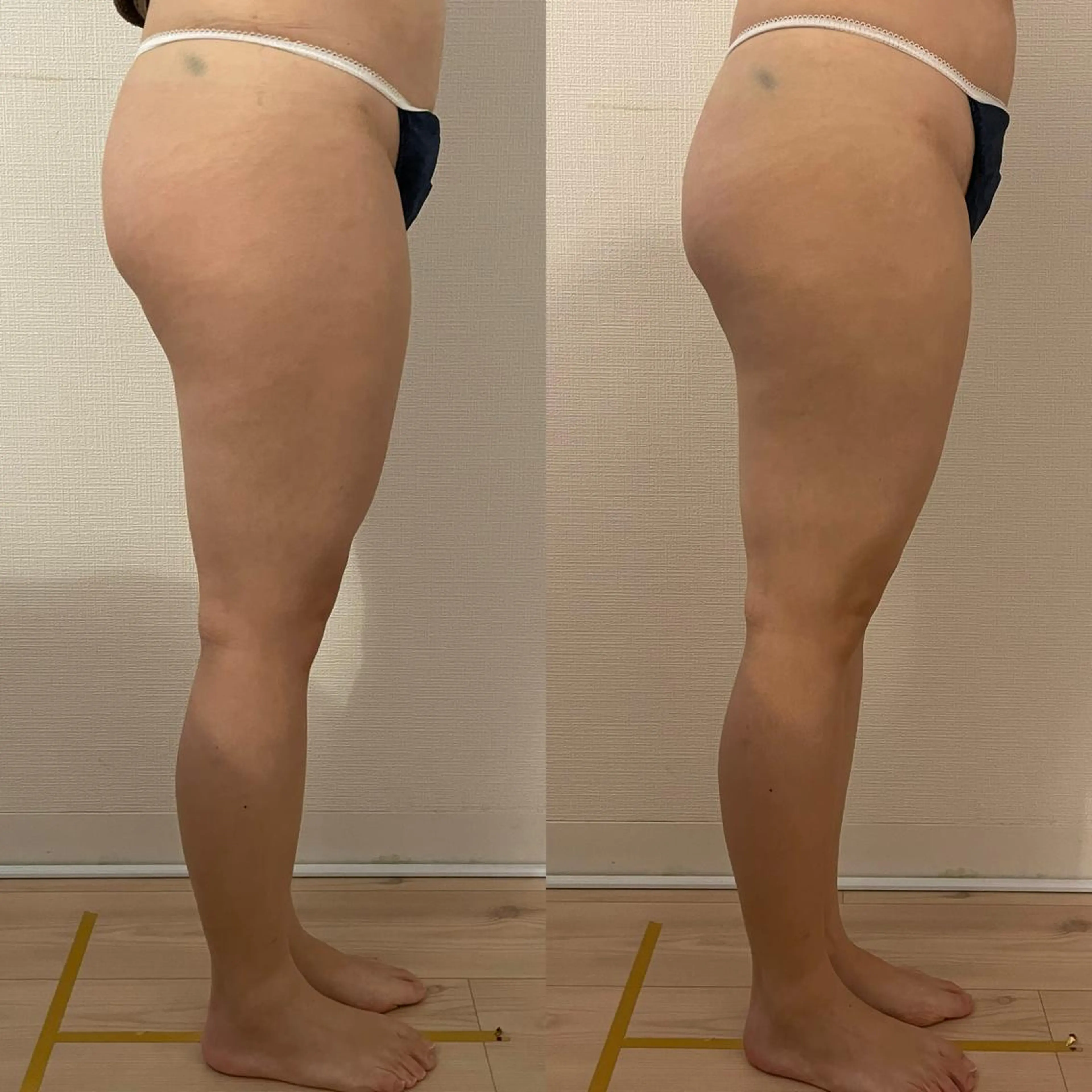 エステ 女性のお悩み美容 サロン ヴィーナスのエステ・リラクイメージ