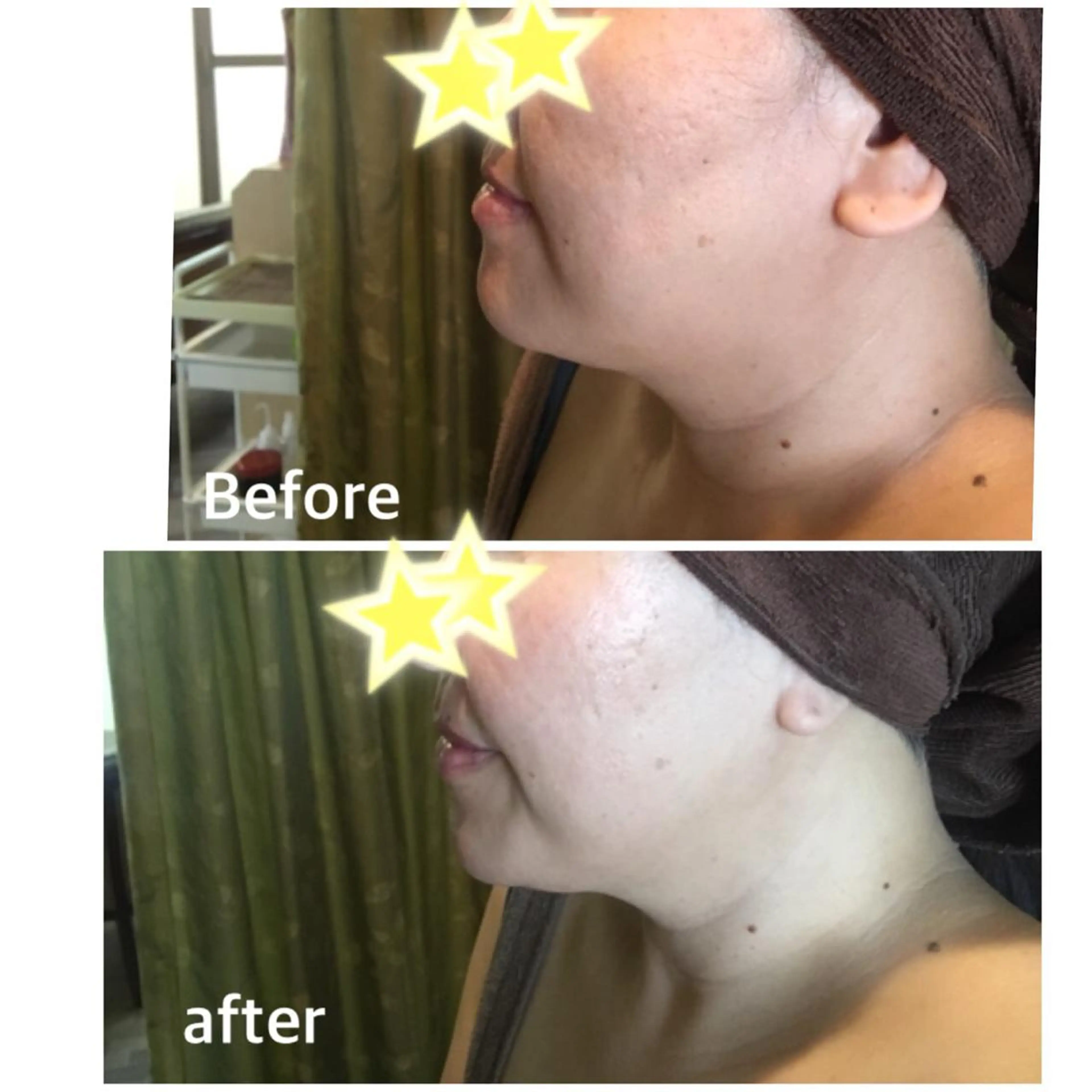 Crown  Jewel所属・CrownJewel クラウン ジュエルのエステ・リラクイメージ