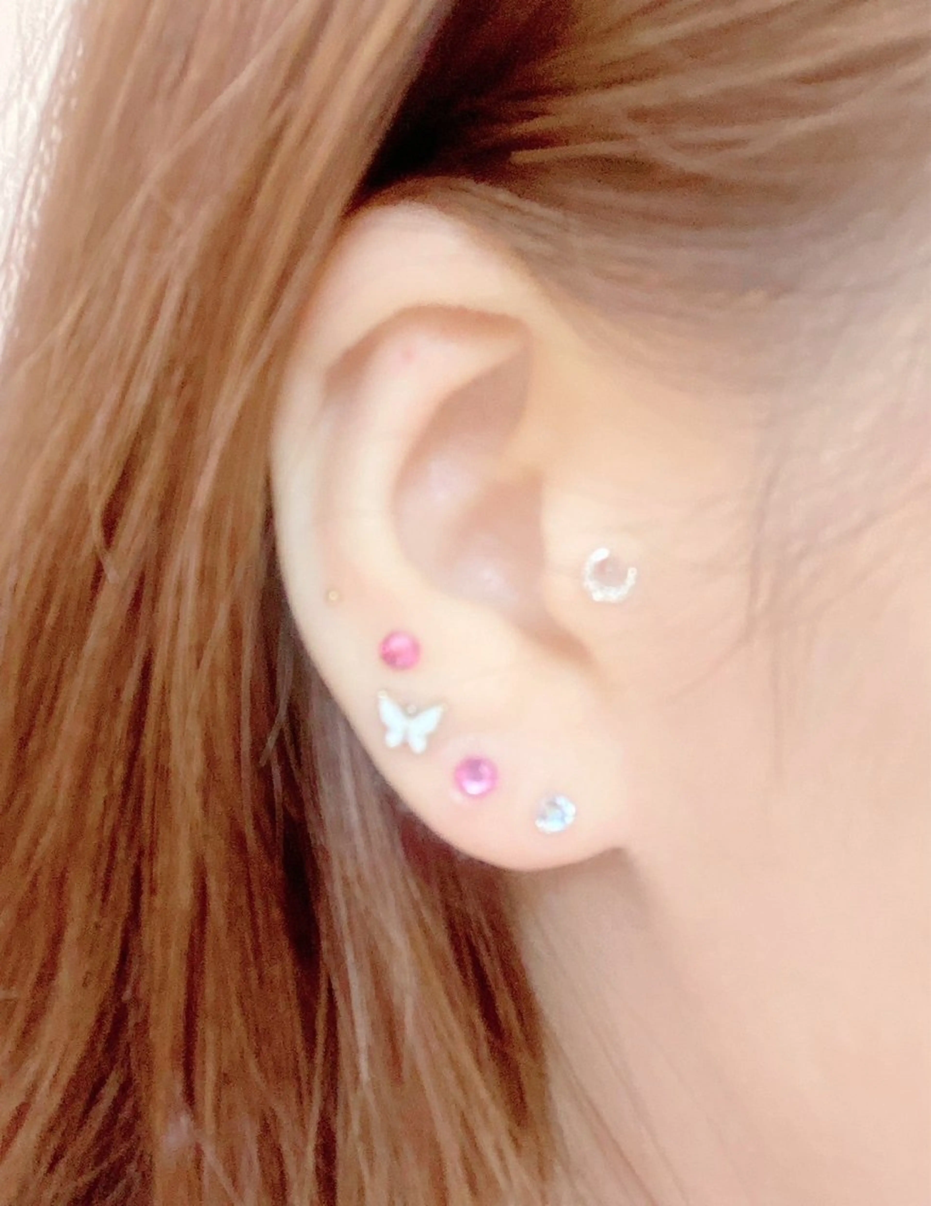 南森町・肌質改善 BELMIMARのエステ・リラクイメージ