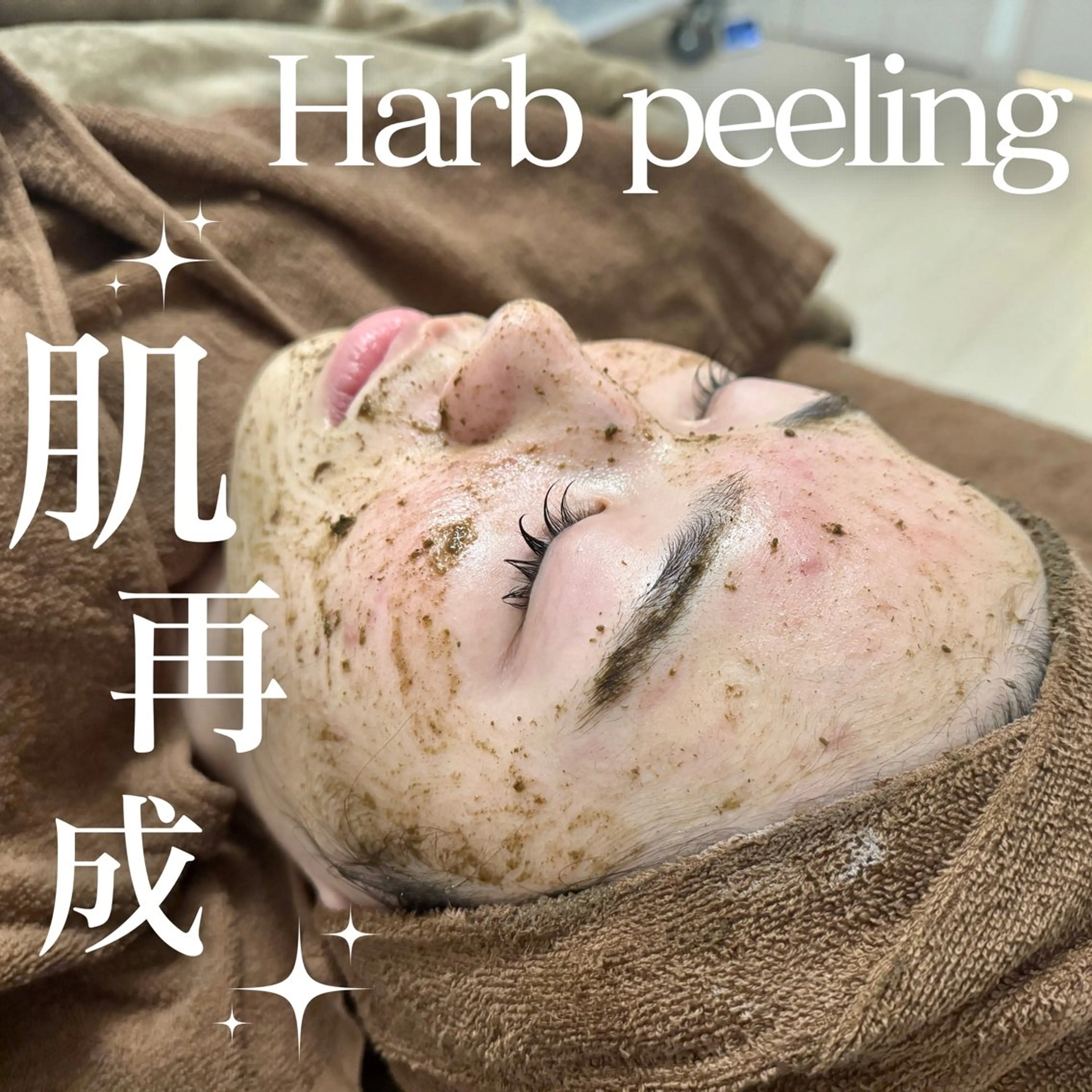 人気No.1👑【剥けない♪本格ニキビケア】話題の陶器肌ハーブピーリング✨敏感肌の方にも安心◎の写真