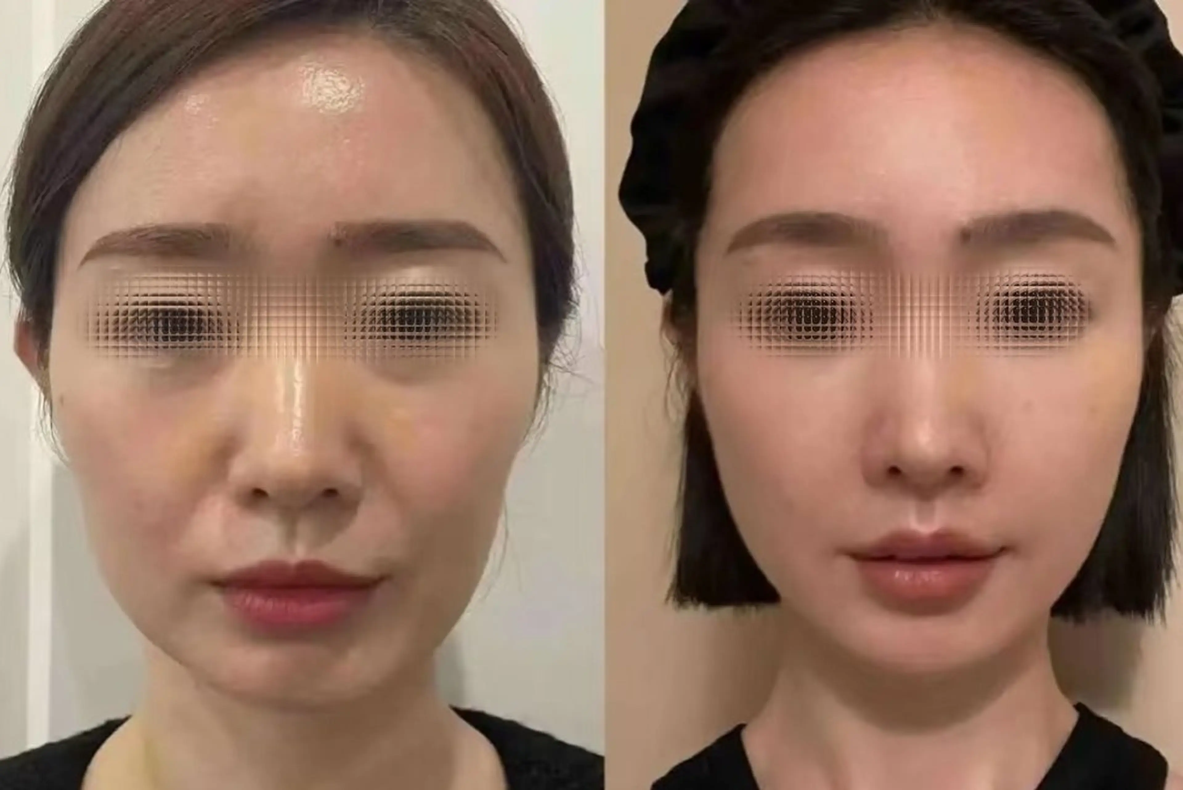 マツエク・マツパ 結婚式・ブライダル aliaハイフ&水光ジェットサロン所属・aliaハーブ水光店 エステティシャン募集のエステ・リラクイメージ