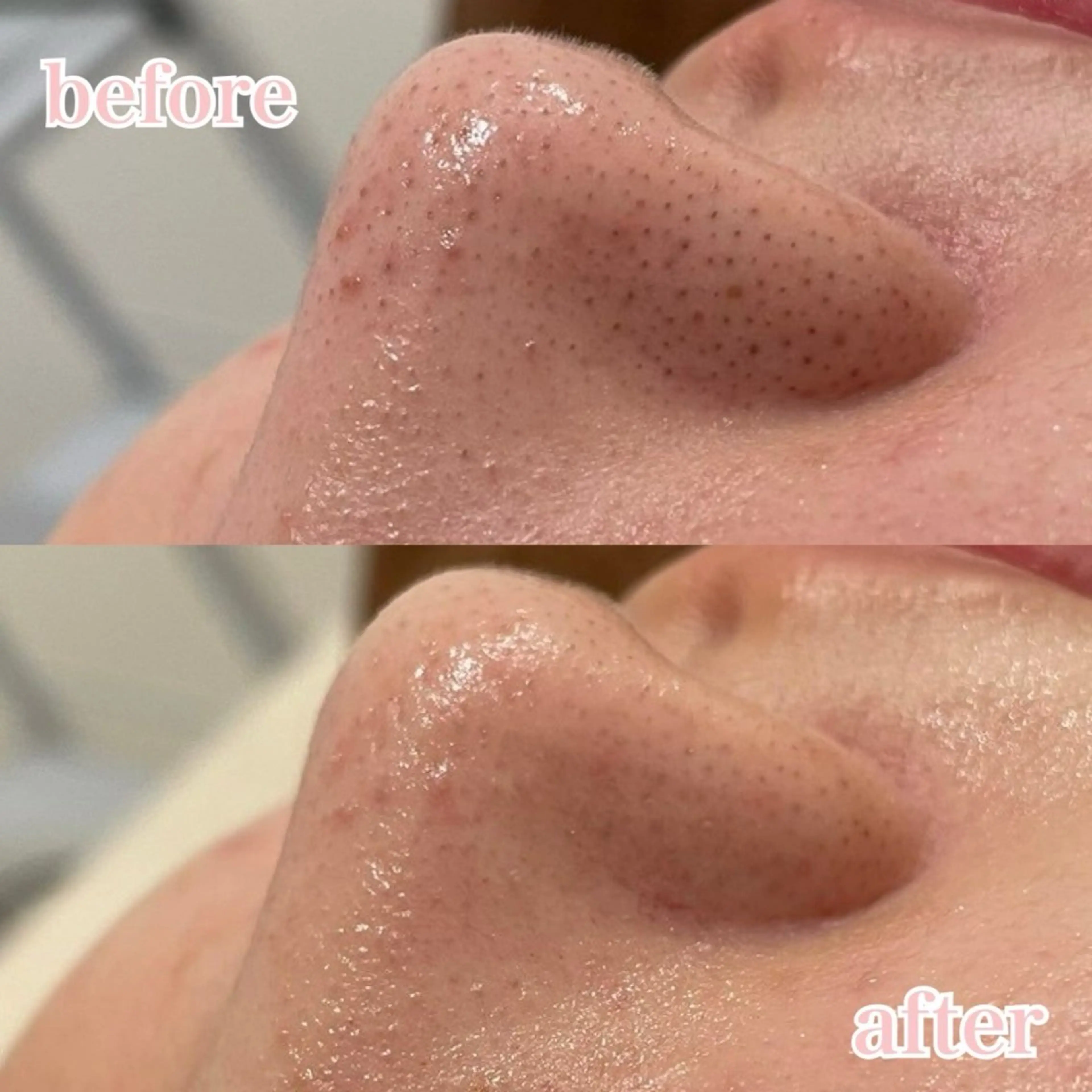 肌管理専門店Whitelabo堺東店所属・おだ あみのエステ・リラクイメージ